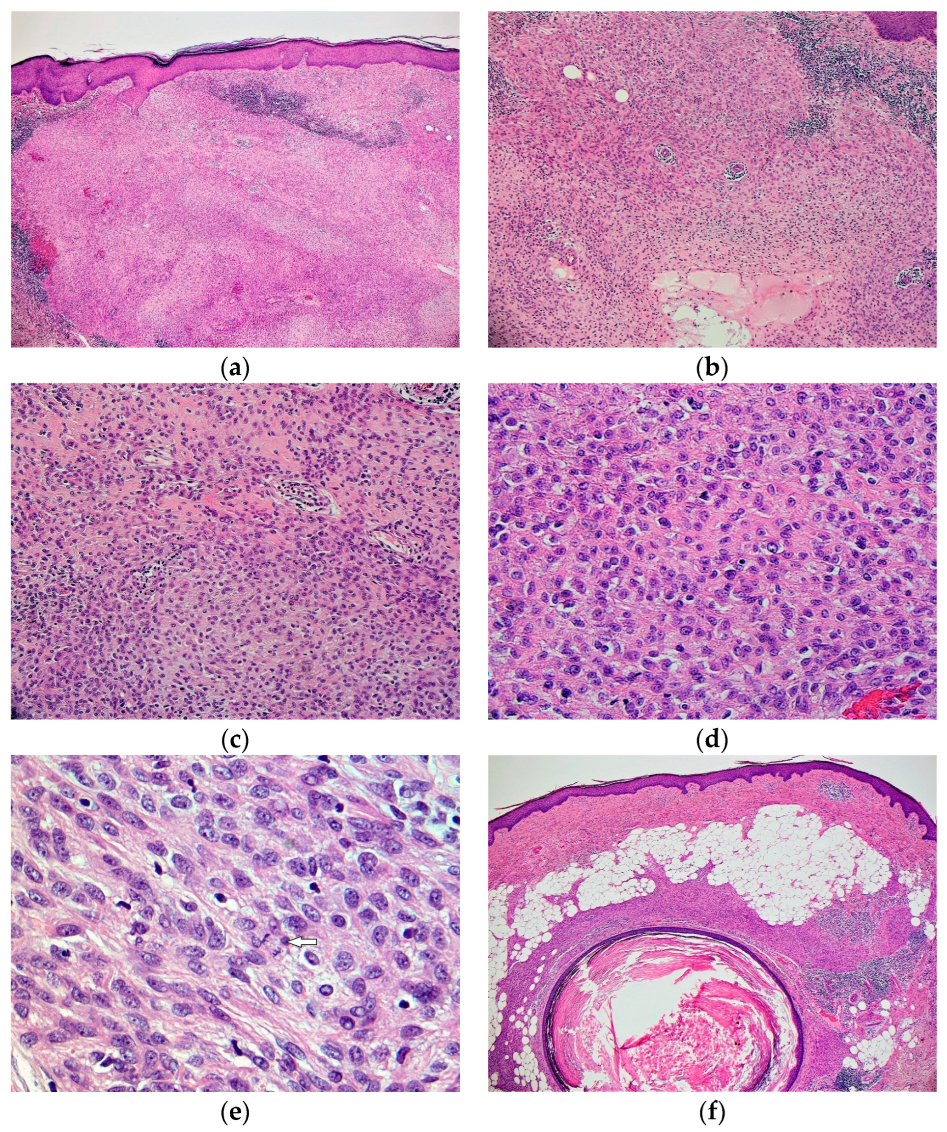 Dermatopathology 10 00030 g001