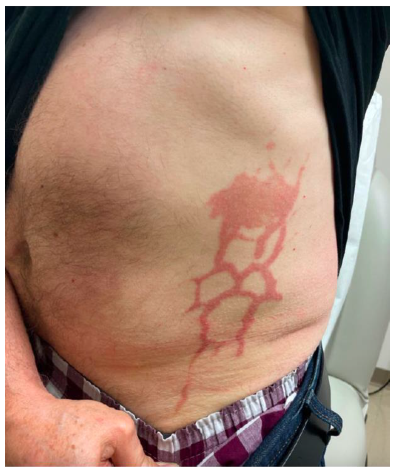 Dermatopathology 10 00031 g001