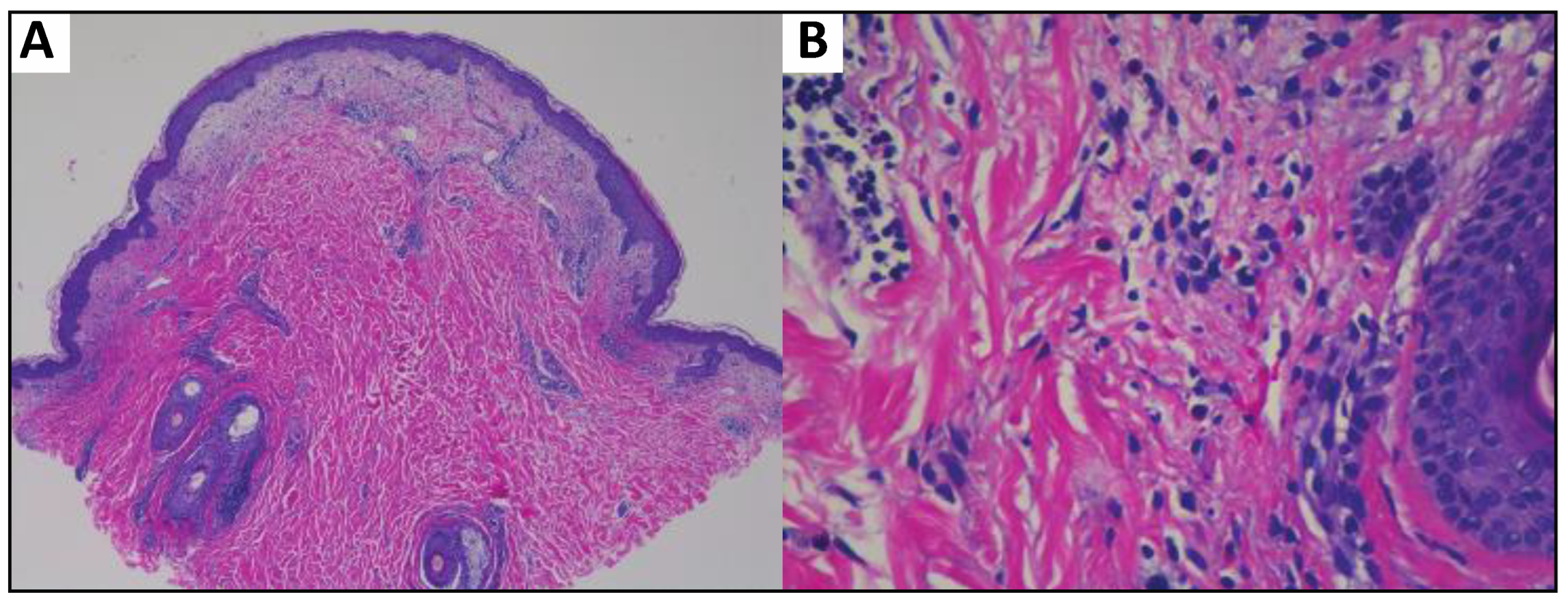 Dermatopathology 10 00031 g002