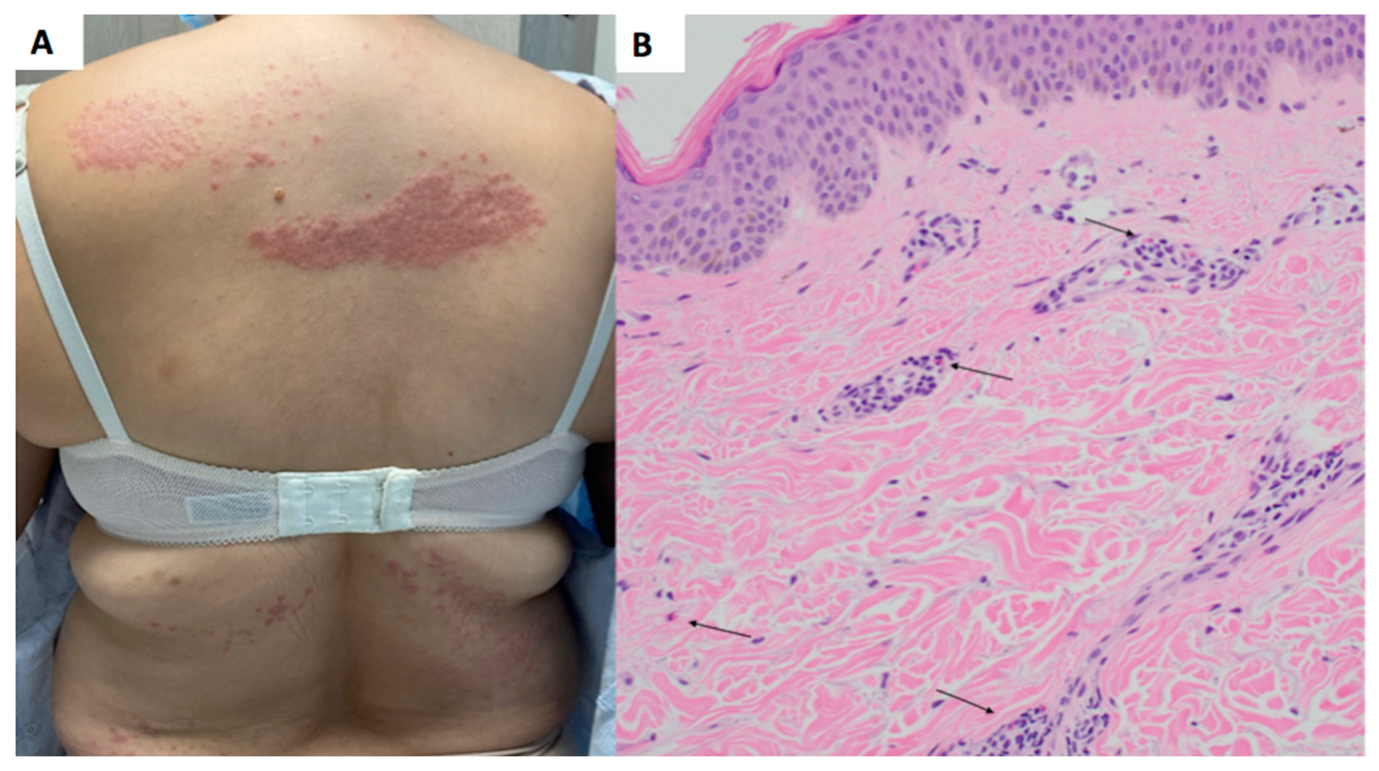 Dermatopathology 10 00039 g001