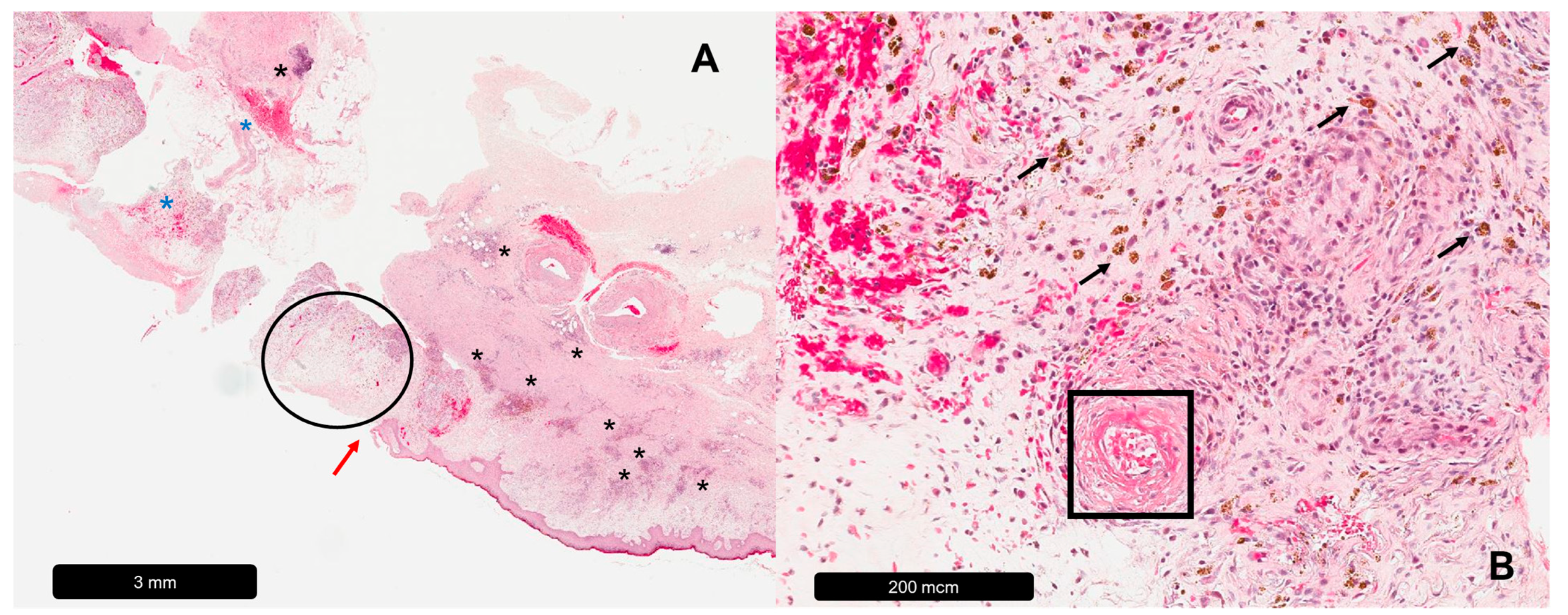 Dermatopathology 11 00007 g001 Dermatopathology 11 00007 g001