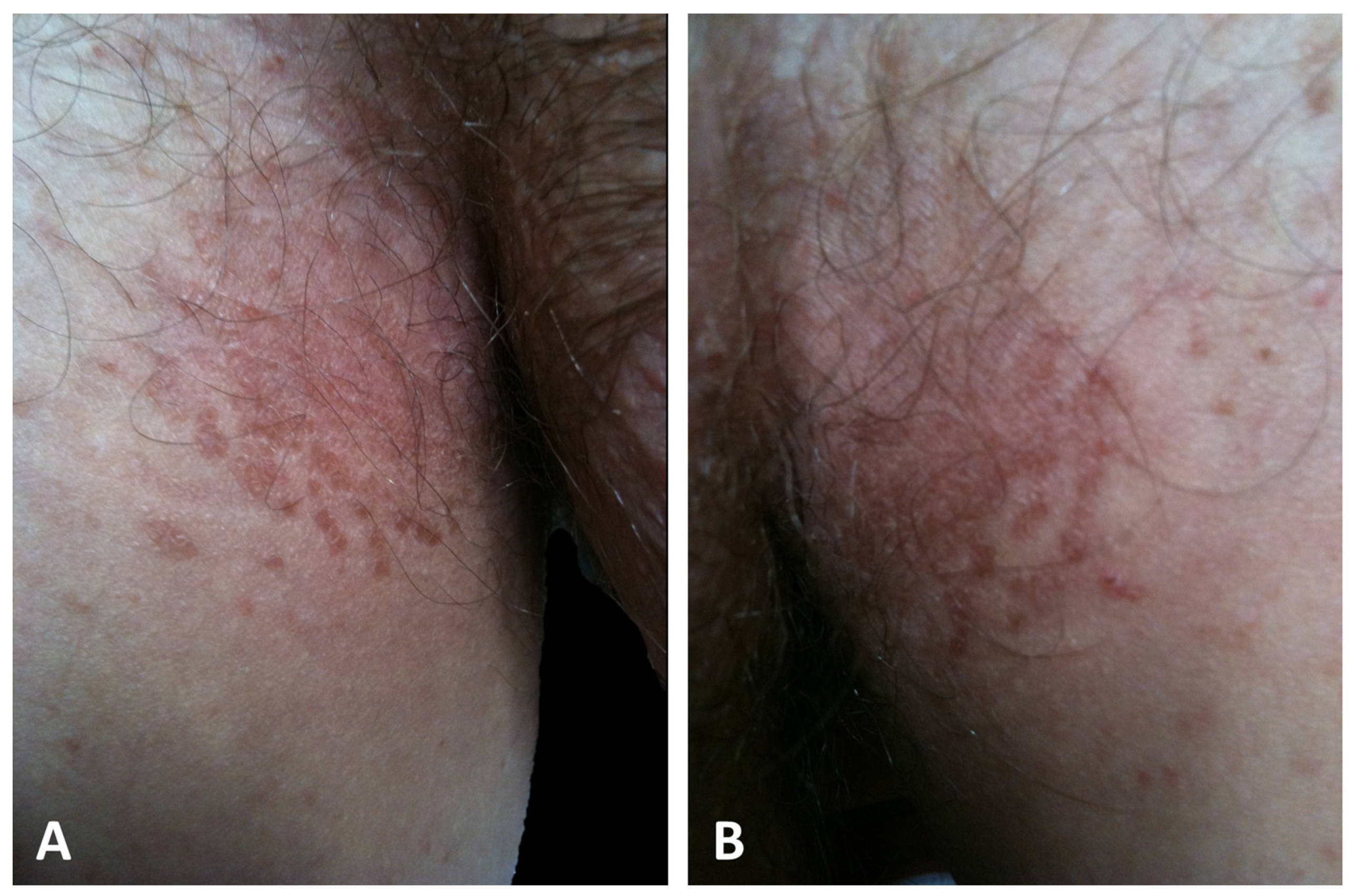 Dermatopathology 11 00008 g003 Dermatopathology 11 00008 g003