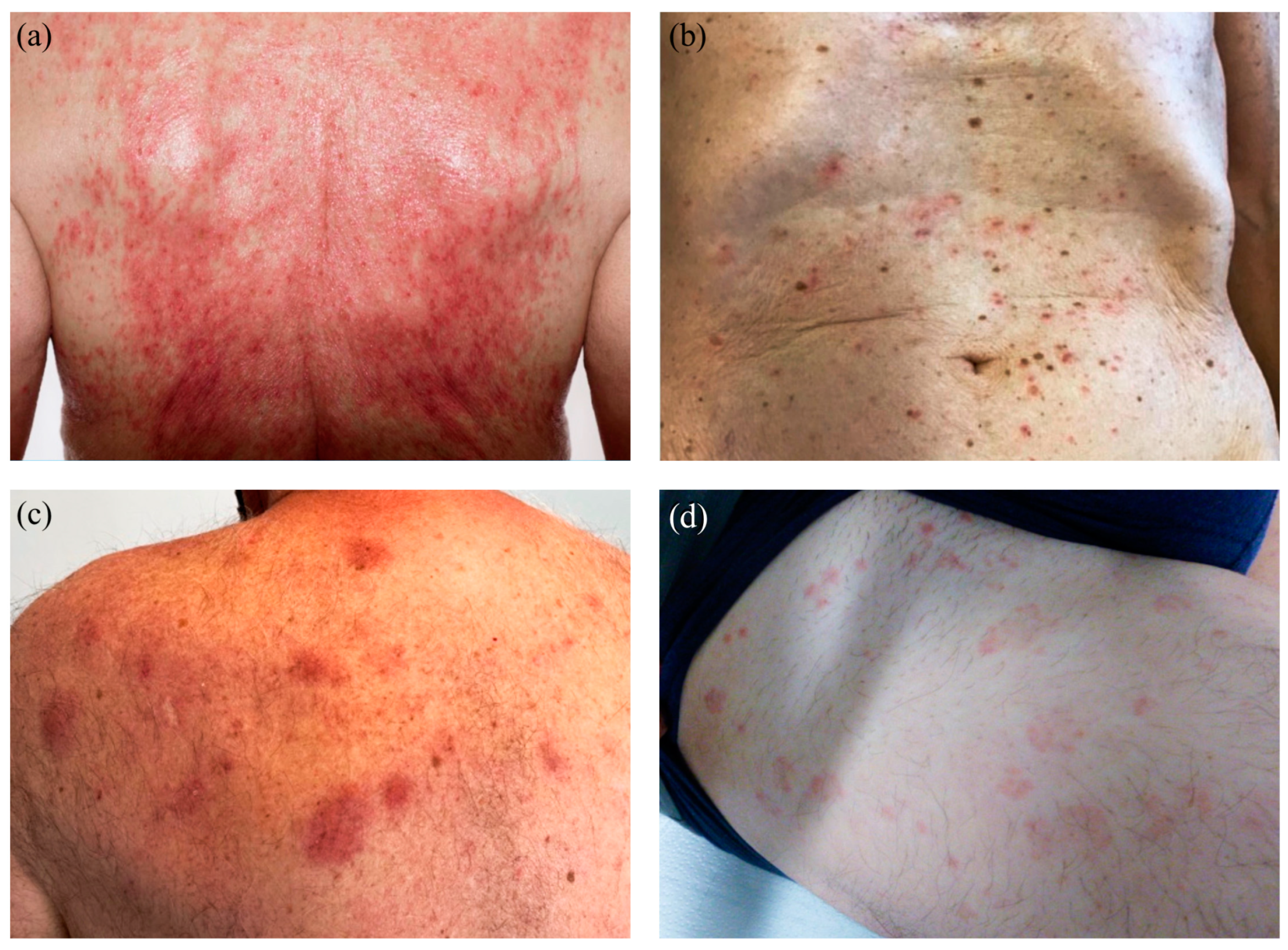 Dermatopathology 11 00013 g002 Dermatopathology 11 00013 g002