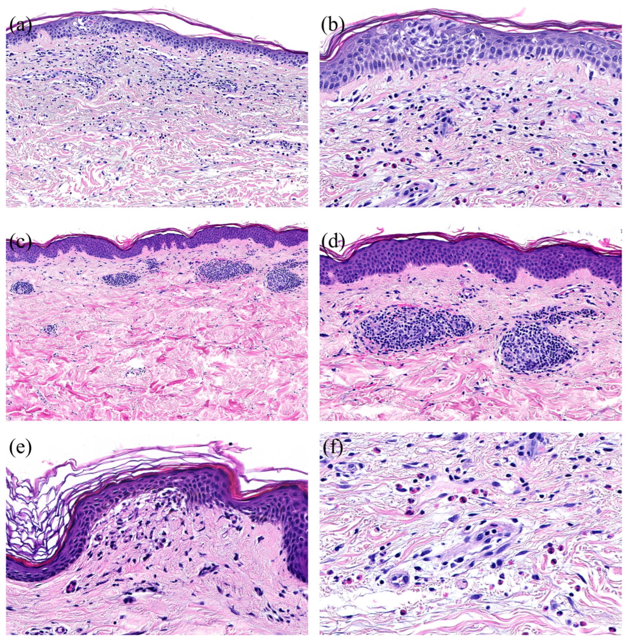 Dermatopathology 11 00013 g004 Dermatopathology 11 00013 g004