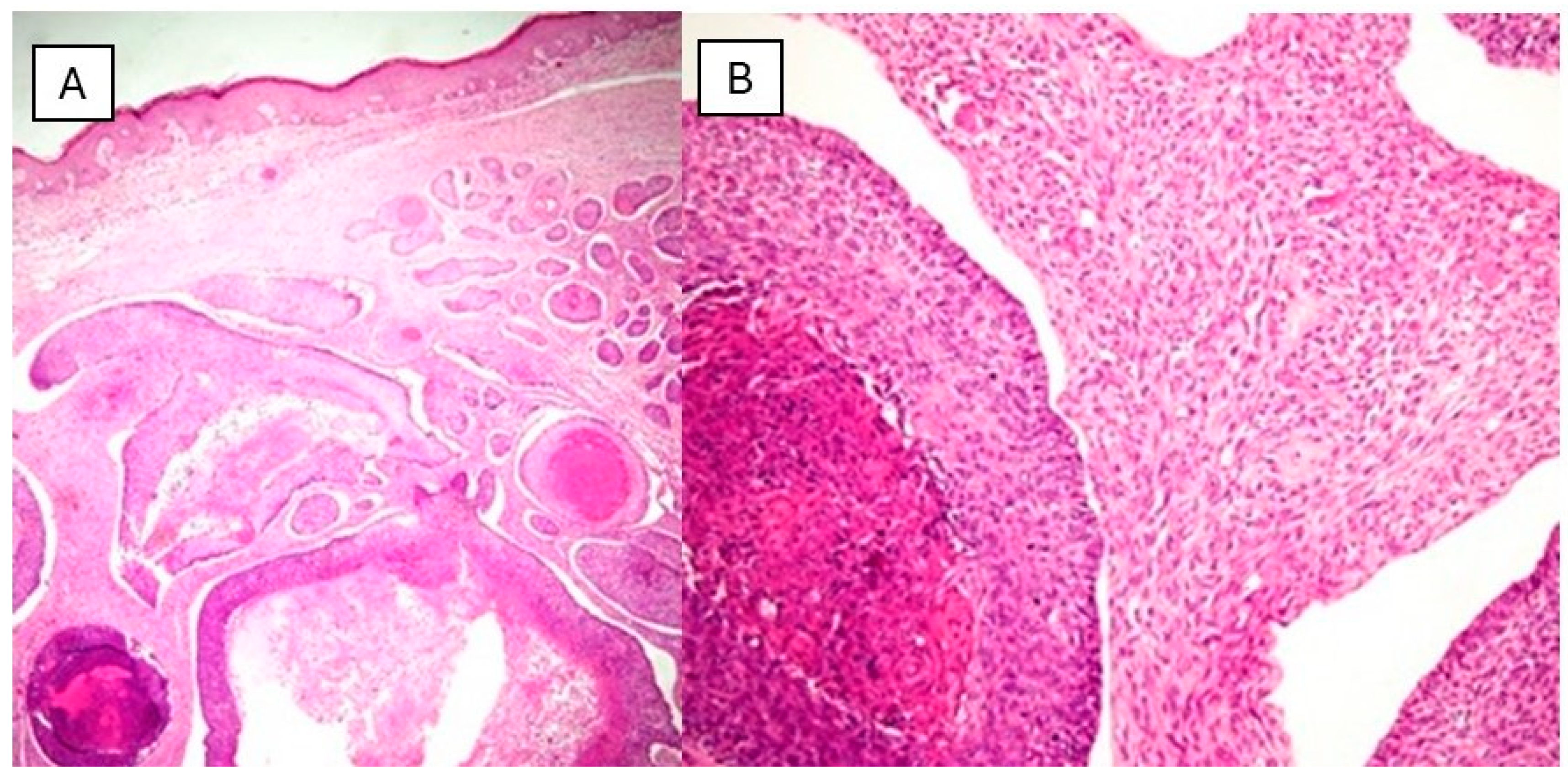 Dermatopathology 11 00022 g004