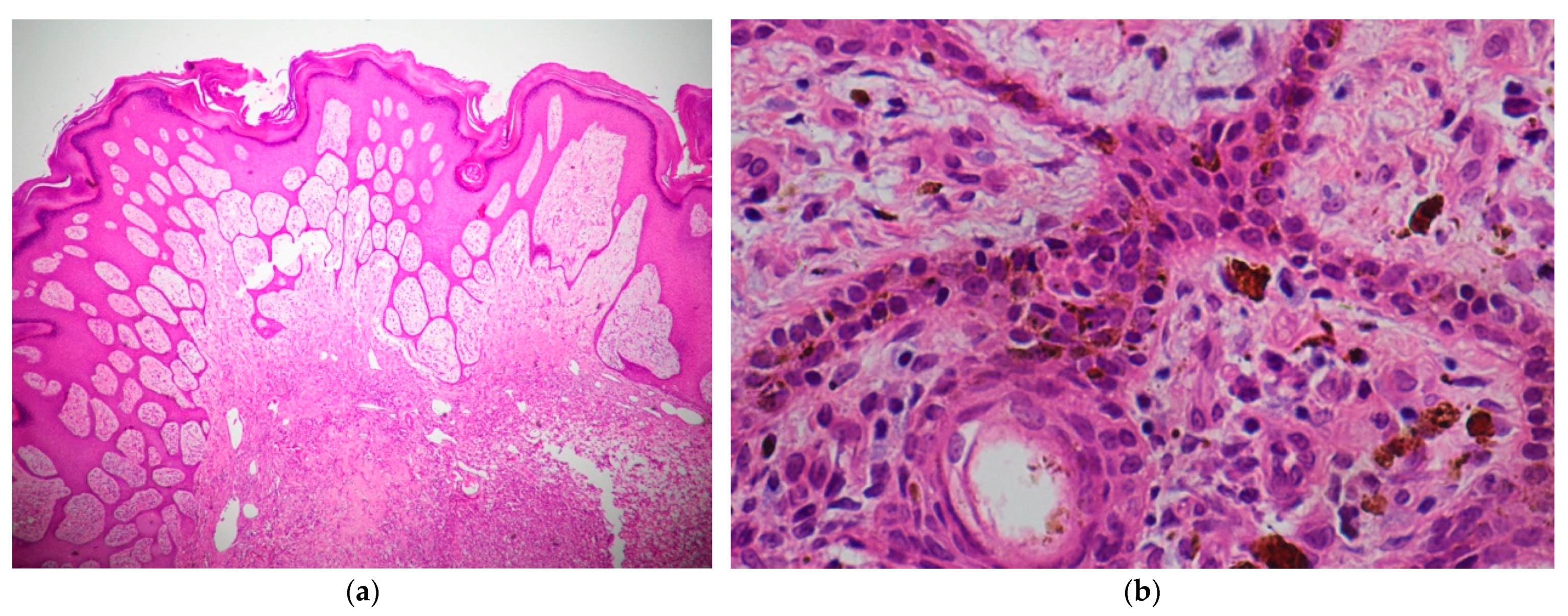 Dermatopathology 11 00030 g005