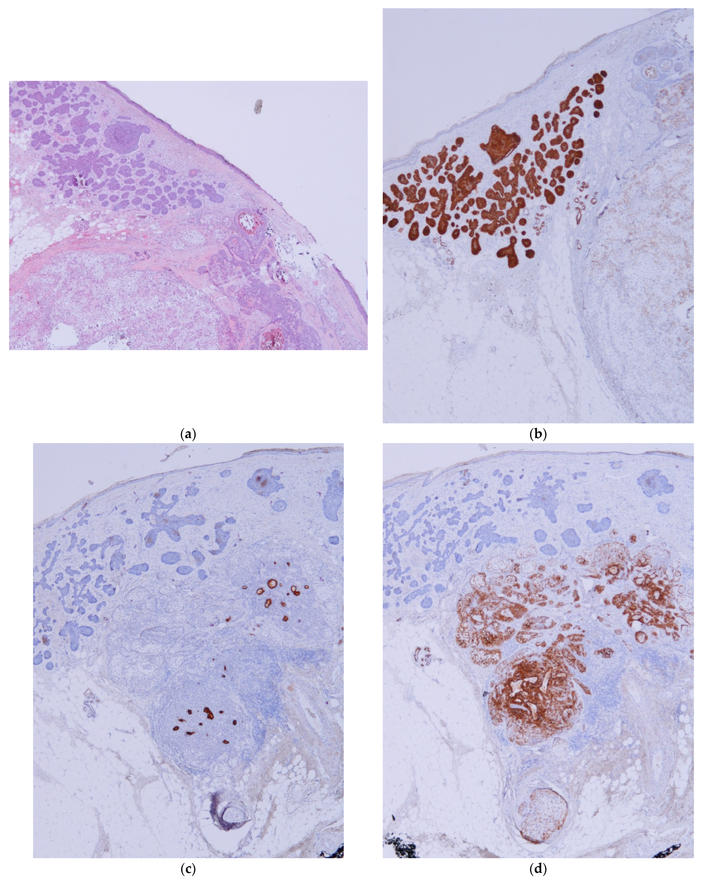 Dermatopathology 11 00032 g006