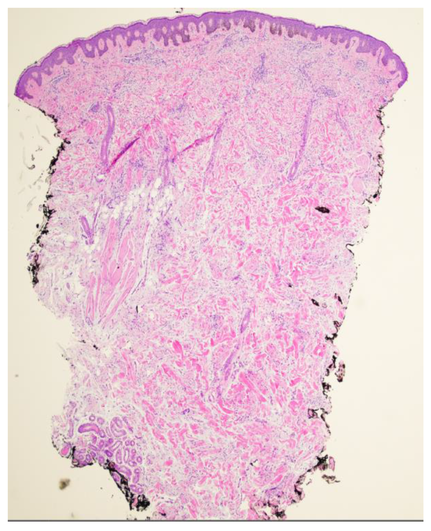 Dermatopathology 11 00036 g002 Dermatopathology 11 00036 g002