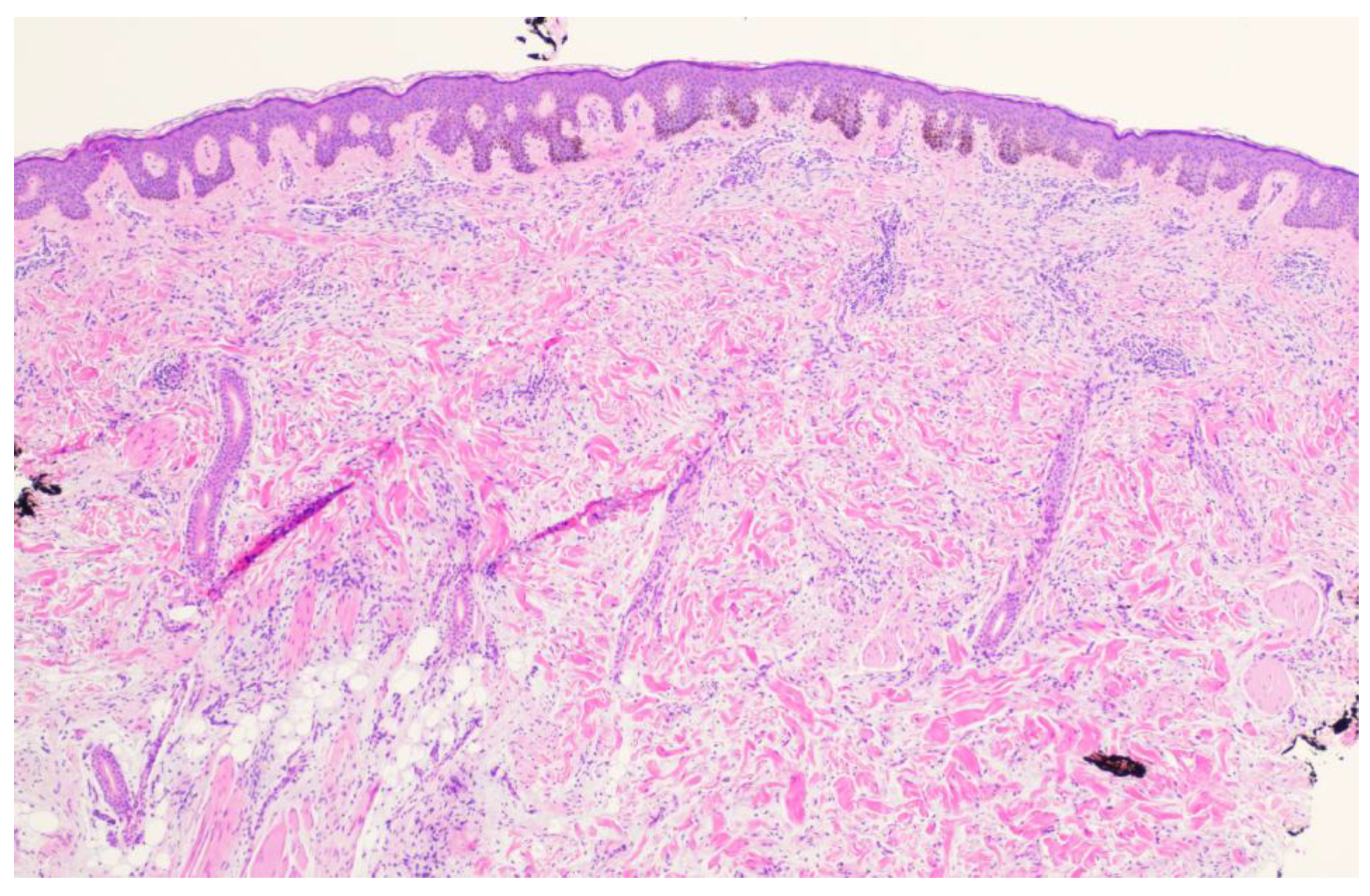 Dermatopathology 11 00036 g003 Dermatopathology 11 00036 g003