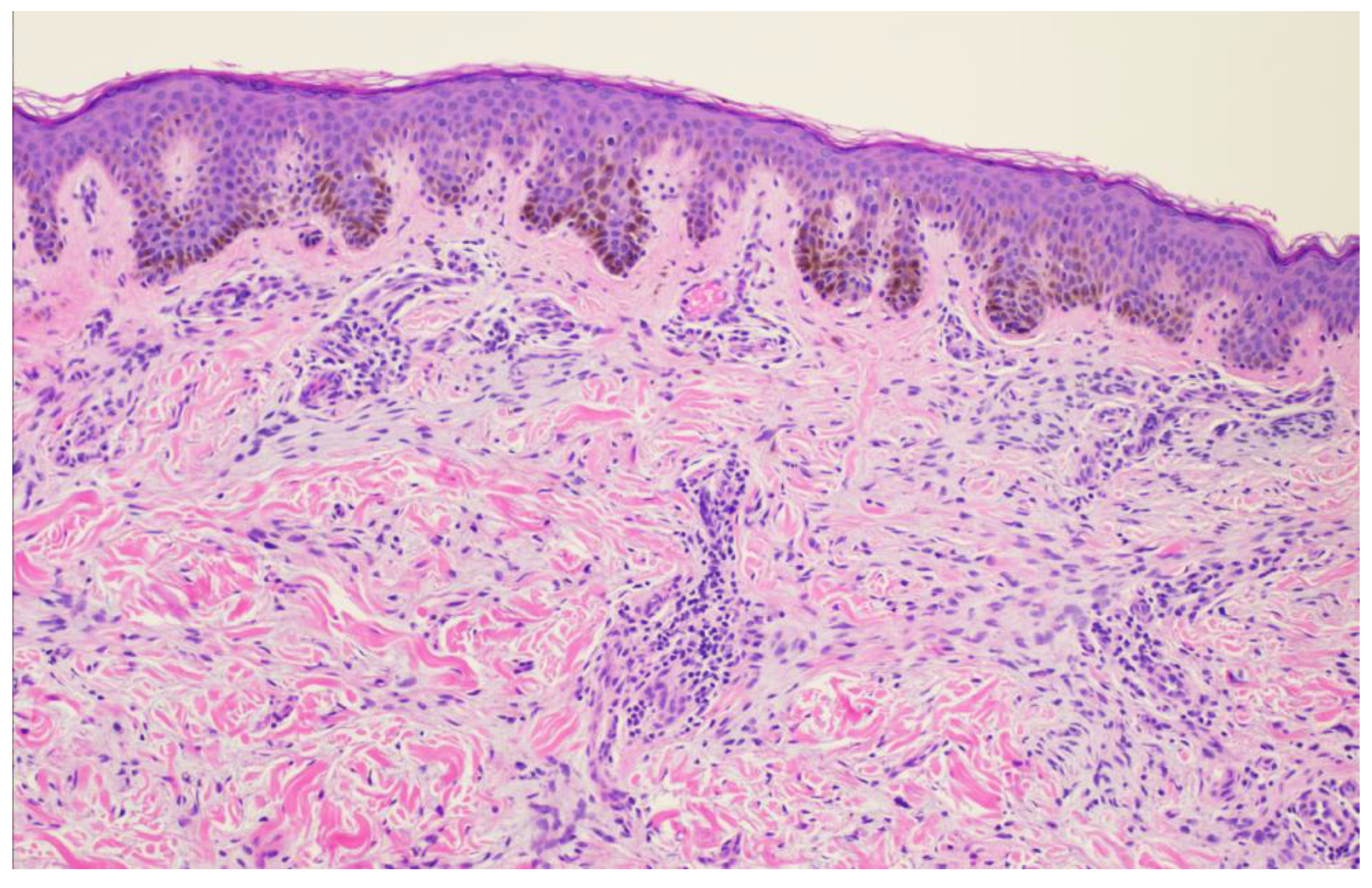 Dermatopathology 11 00036 g004 Dermatopathology 11 00036 g004