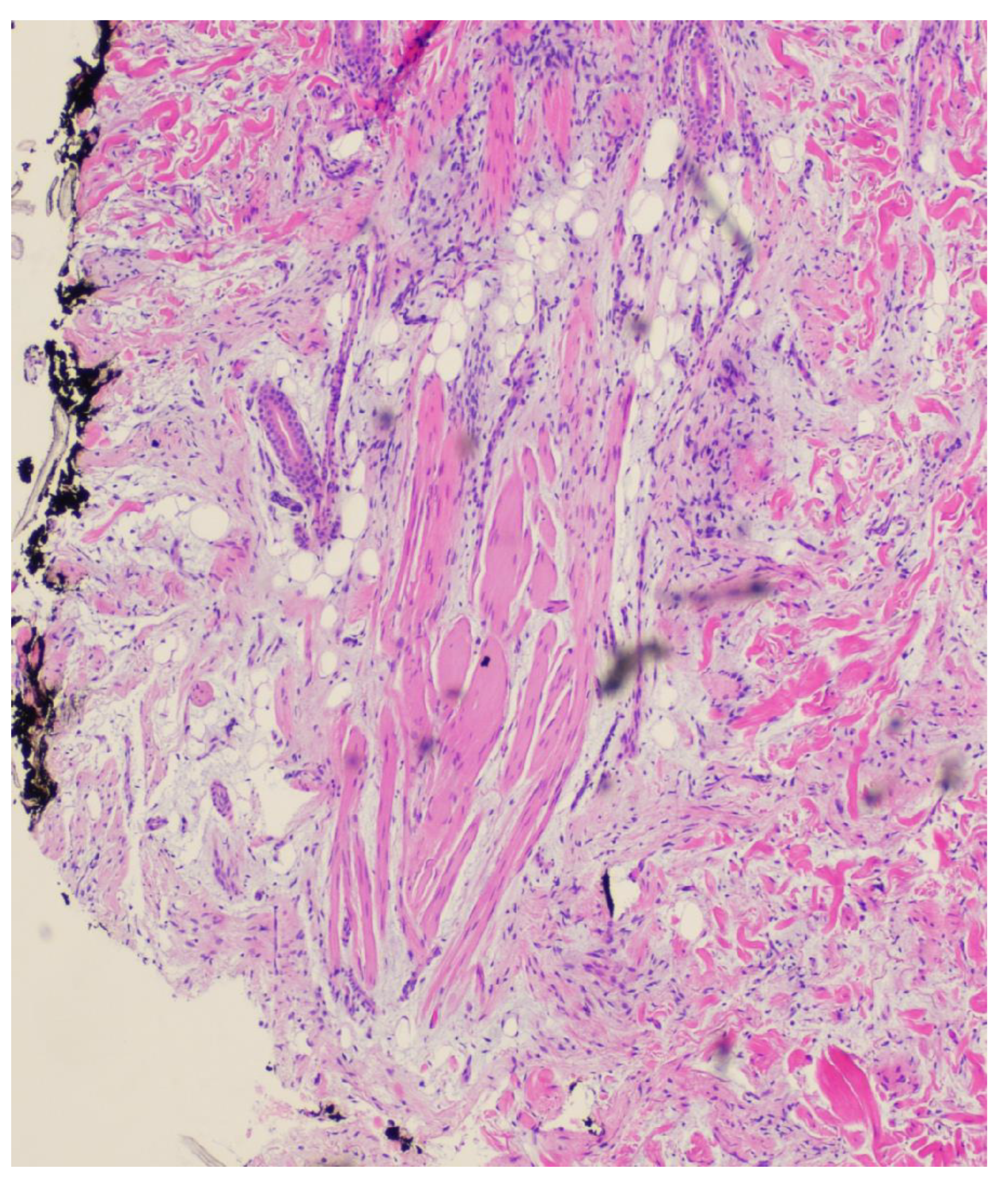 Dermatopathology 11 00036 g005 Dermatopathology 11 00036 g005