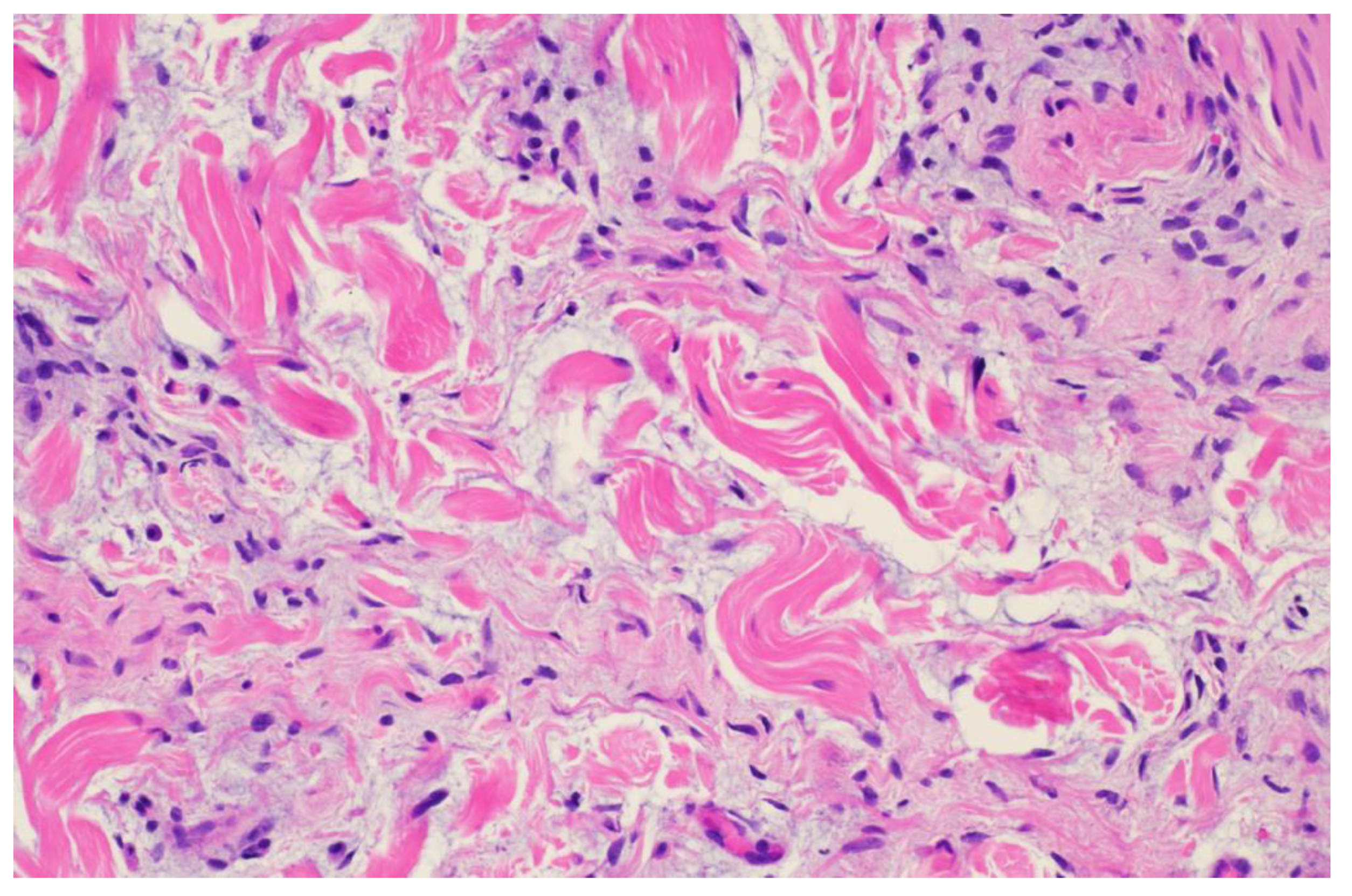 Dermatopathology 11 00036 g006 Dermatopathology 11 00036 g006