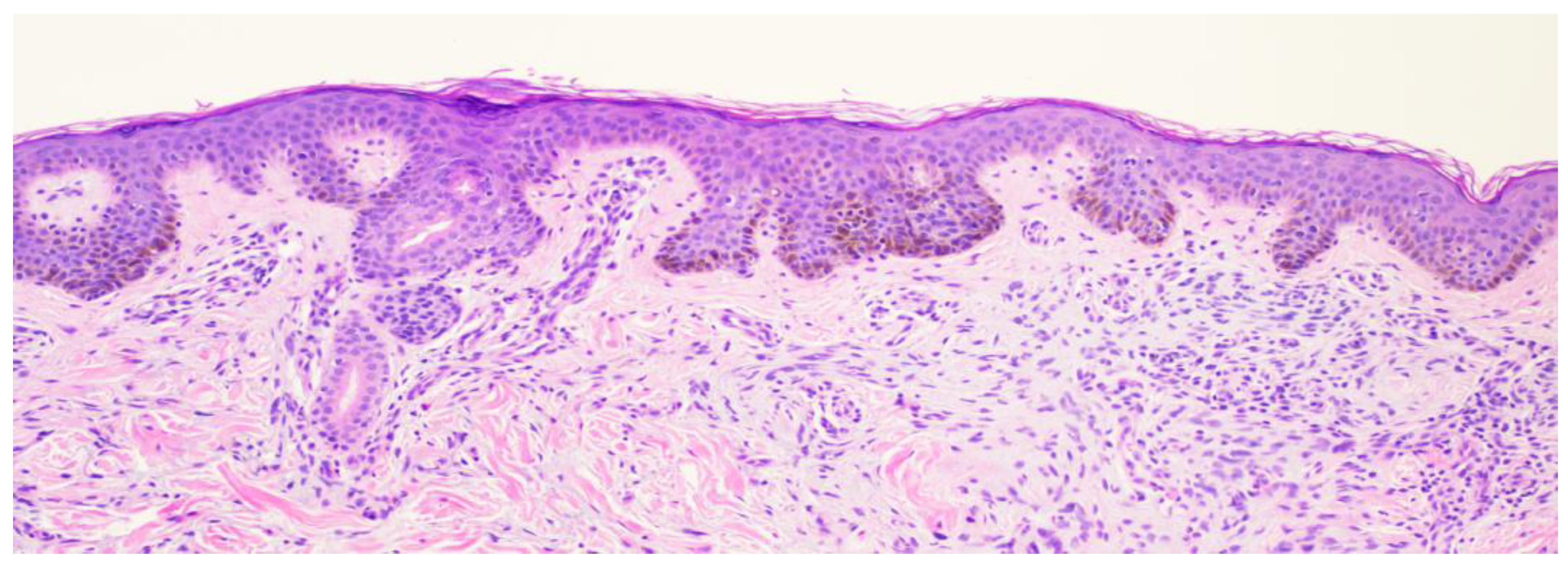 Dermatopathology 11 00036 g007 Dermatopathology 11 00036 g007