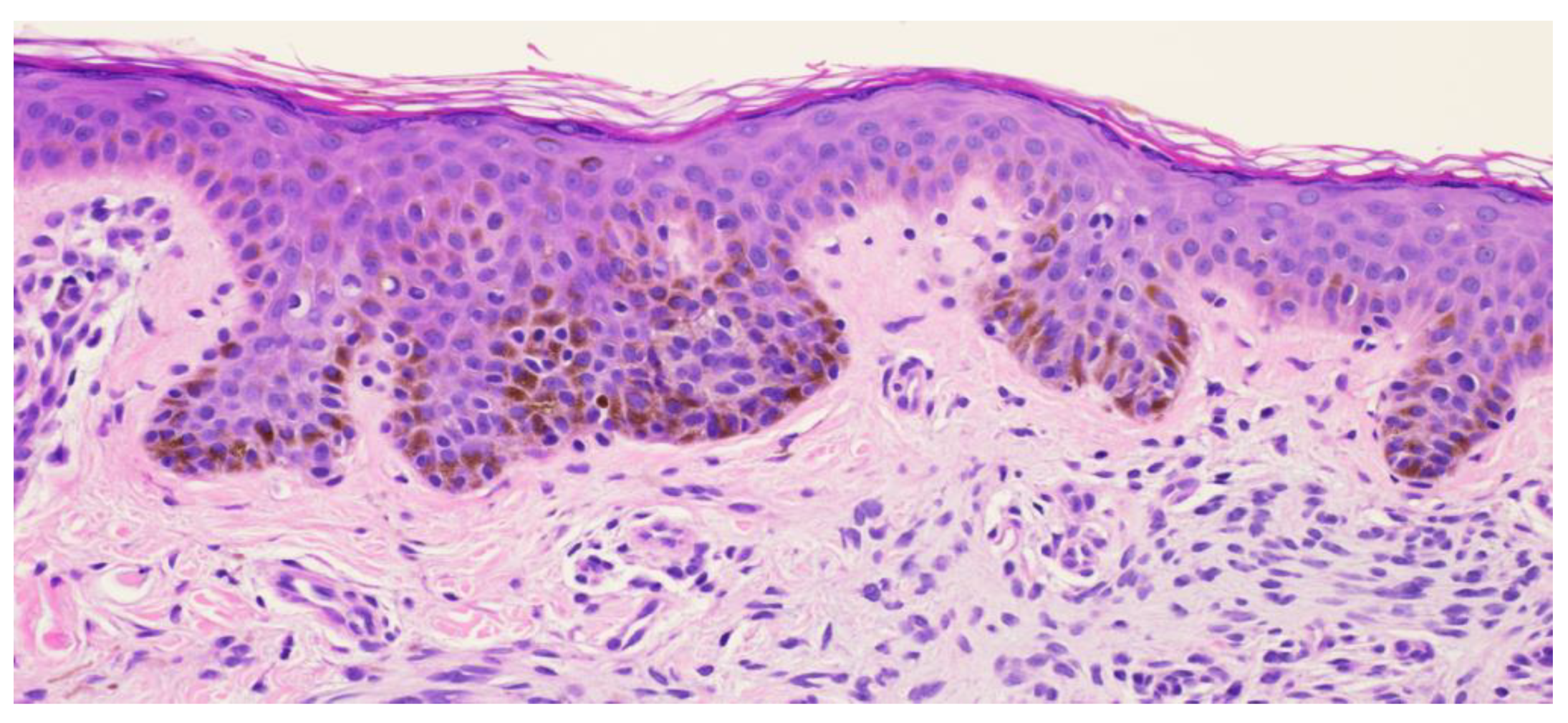 Dermatopathology 11 00036 g008 Dermatopathology 11 00036 g008