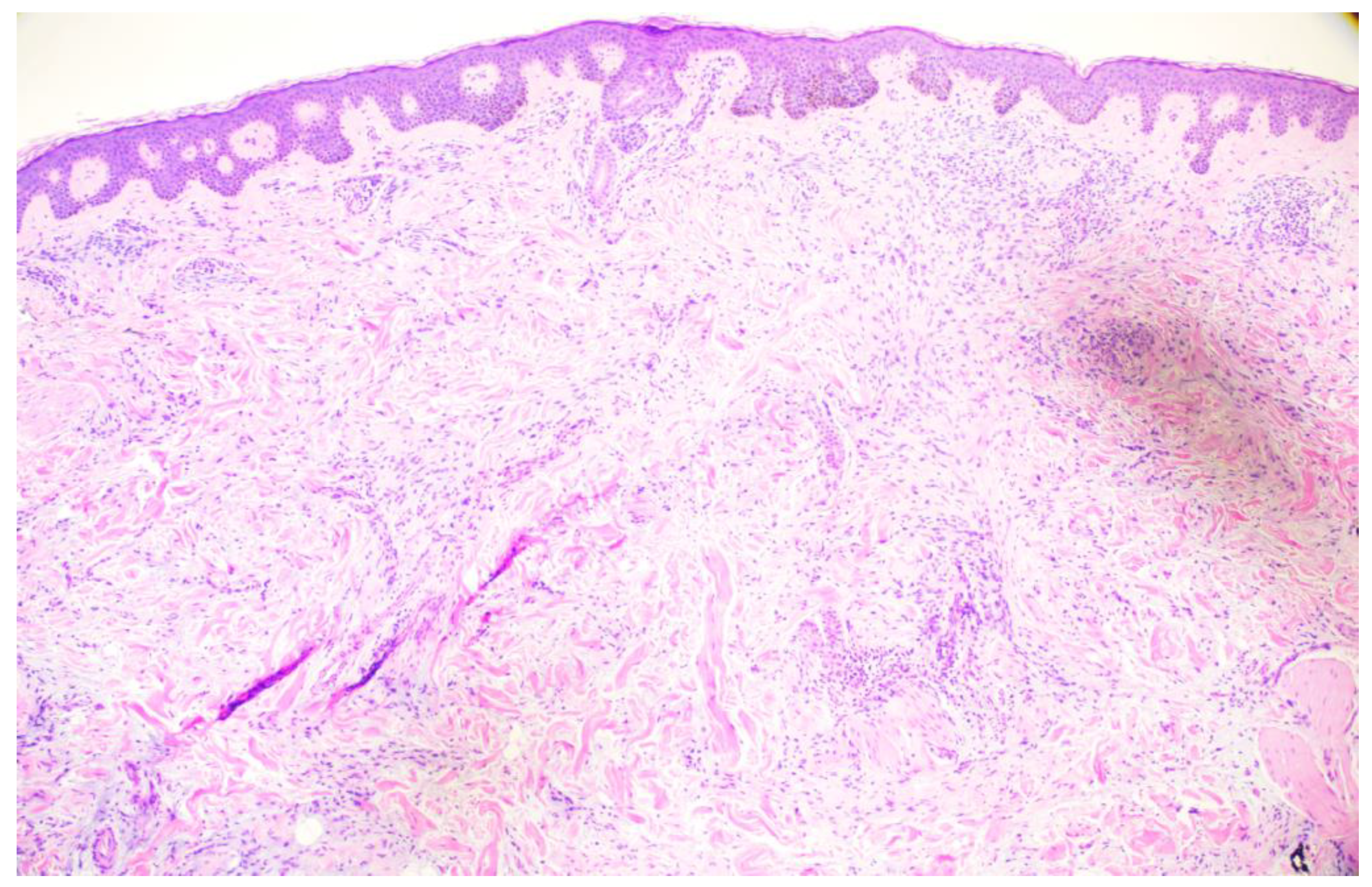 Dermatopathology 11 00036 g009 Dermatopathology 11 00036 g009