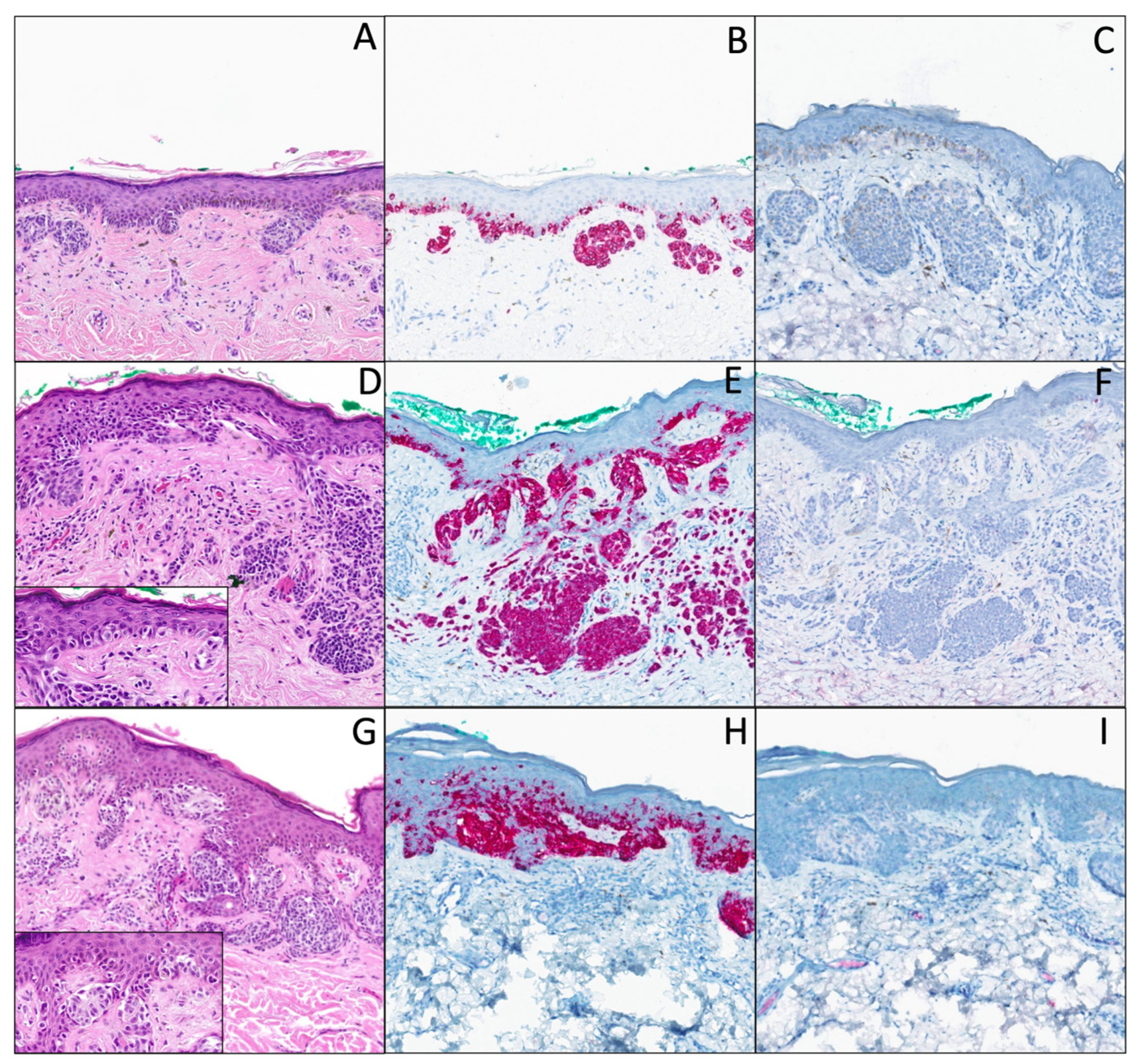 Dermatopathology 12 00003 g002