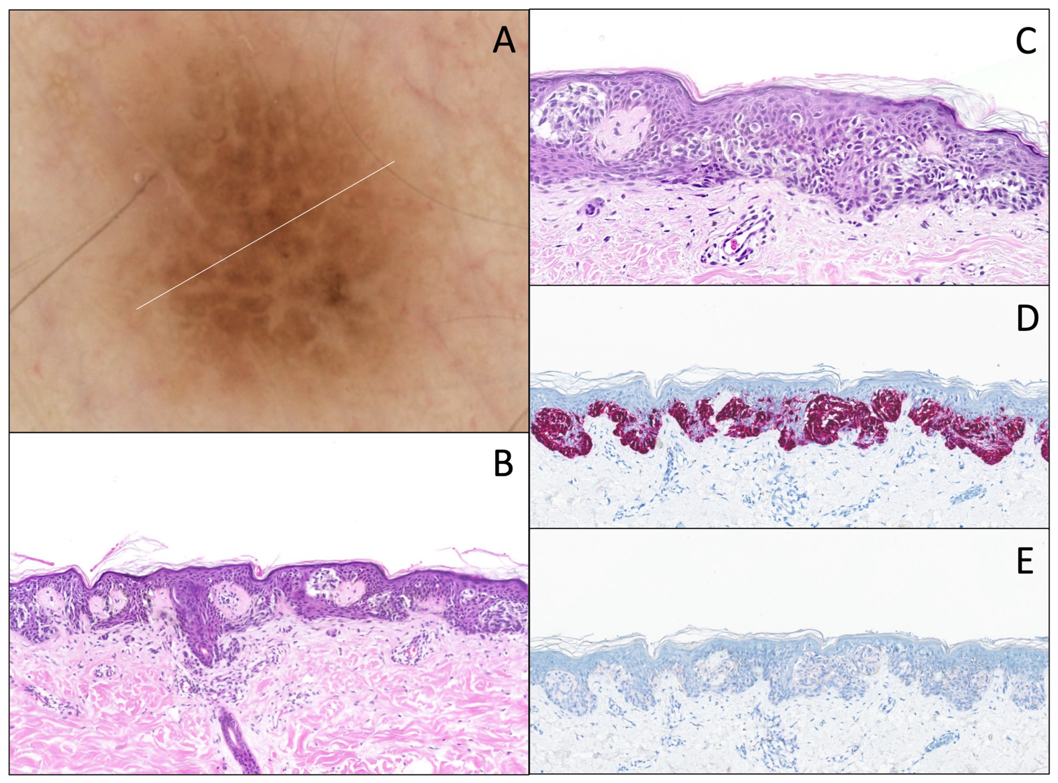 Dermatopathology 12 00003 g006