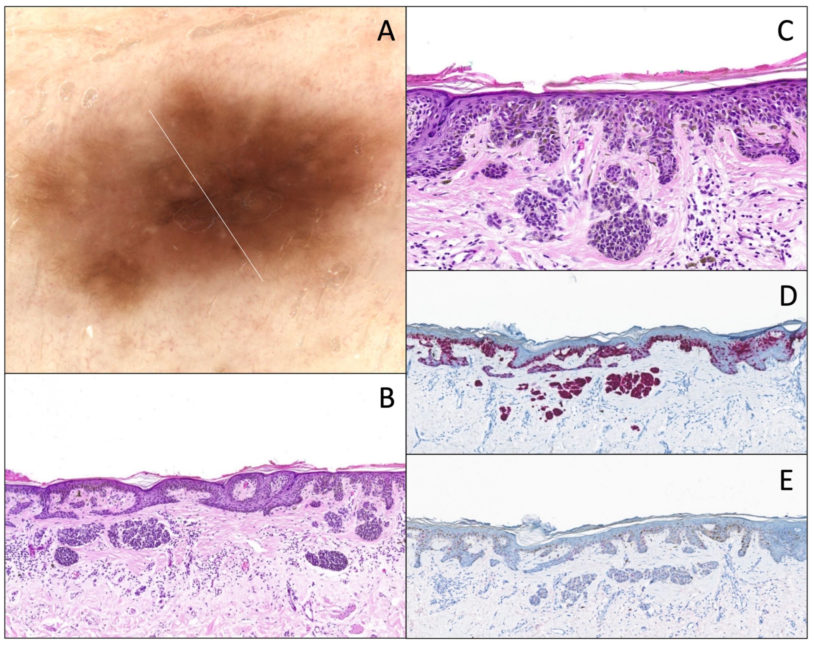 Dermatopathology 12 00003 g007