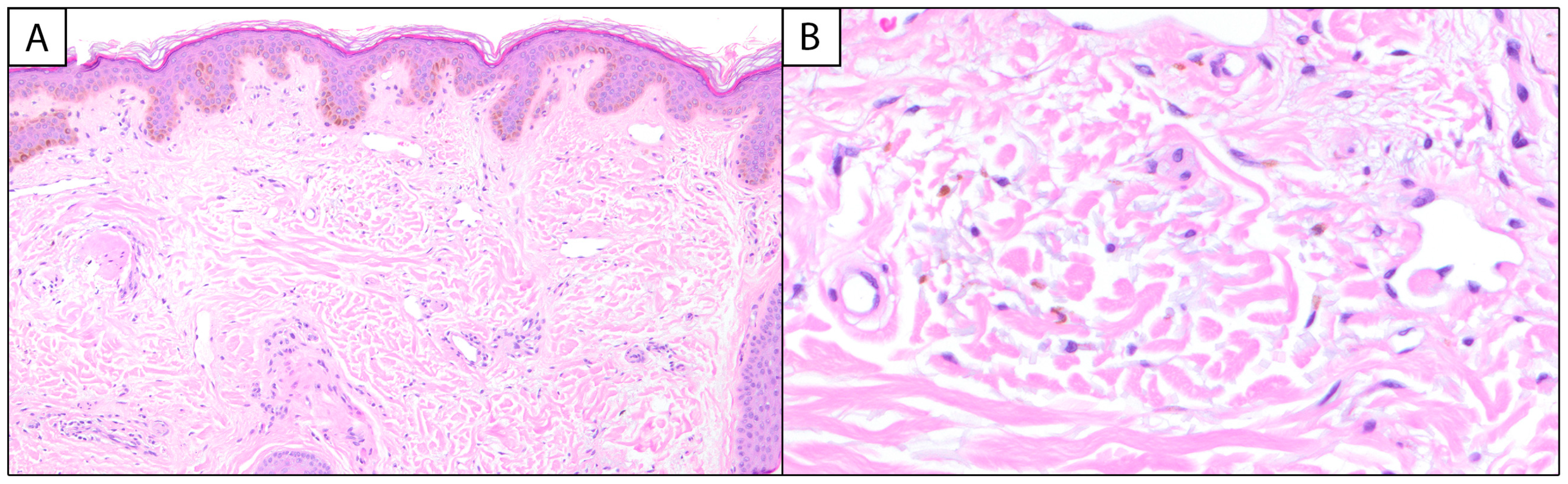Dermatopathology 12 00013 g001