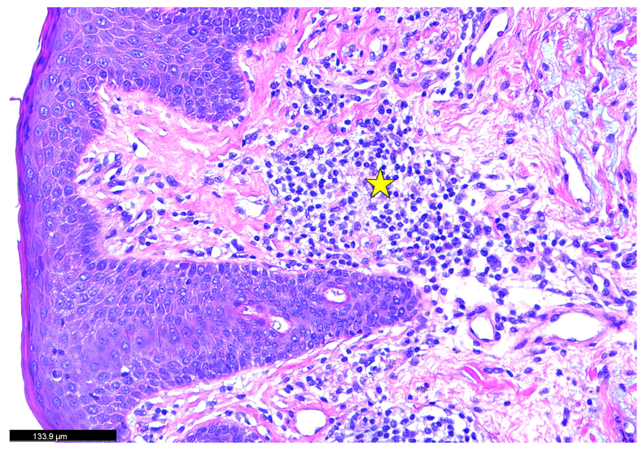 Dermatopathology 12 00017 g003