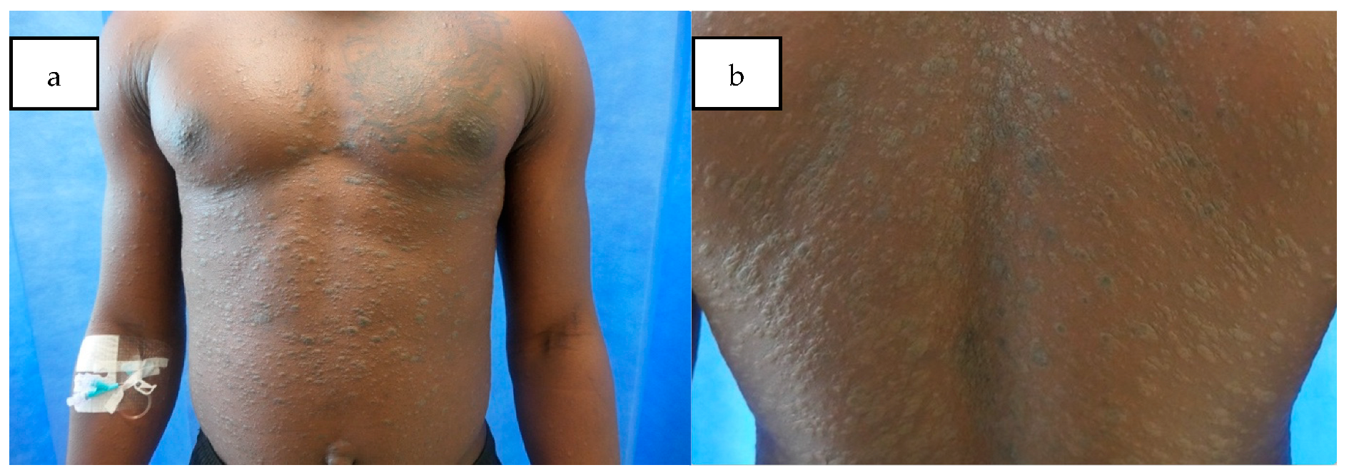 Dermatopathology 12 00021 g001