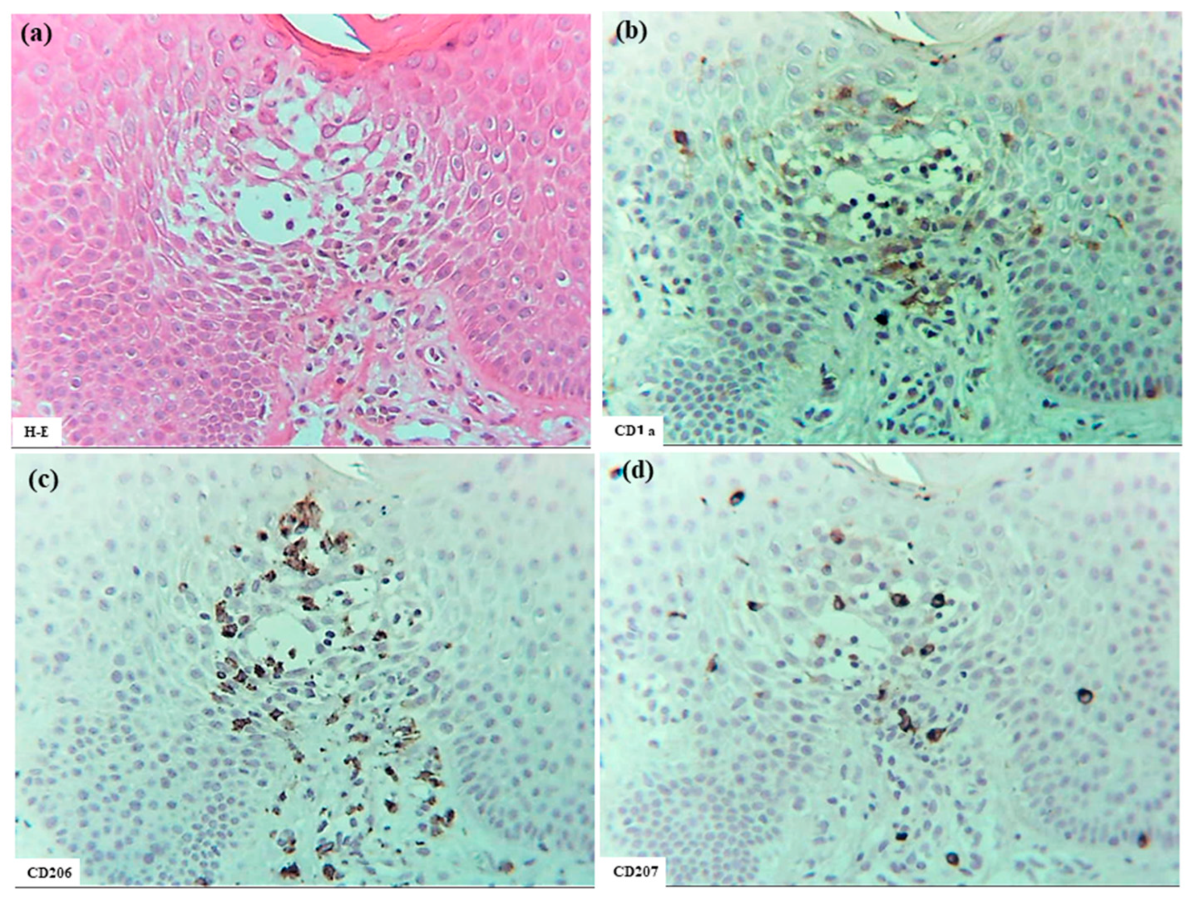Dermatopathology 12 00023 g001a