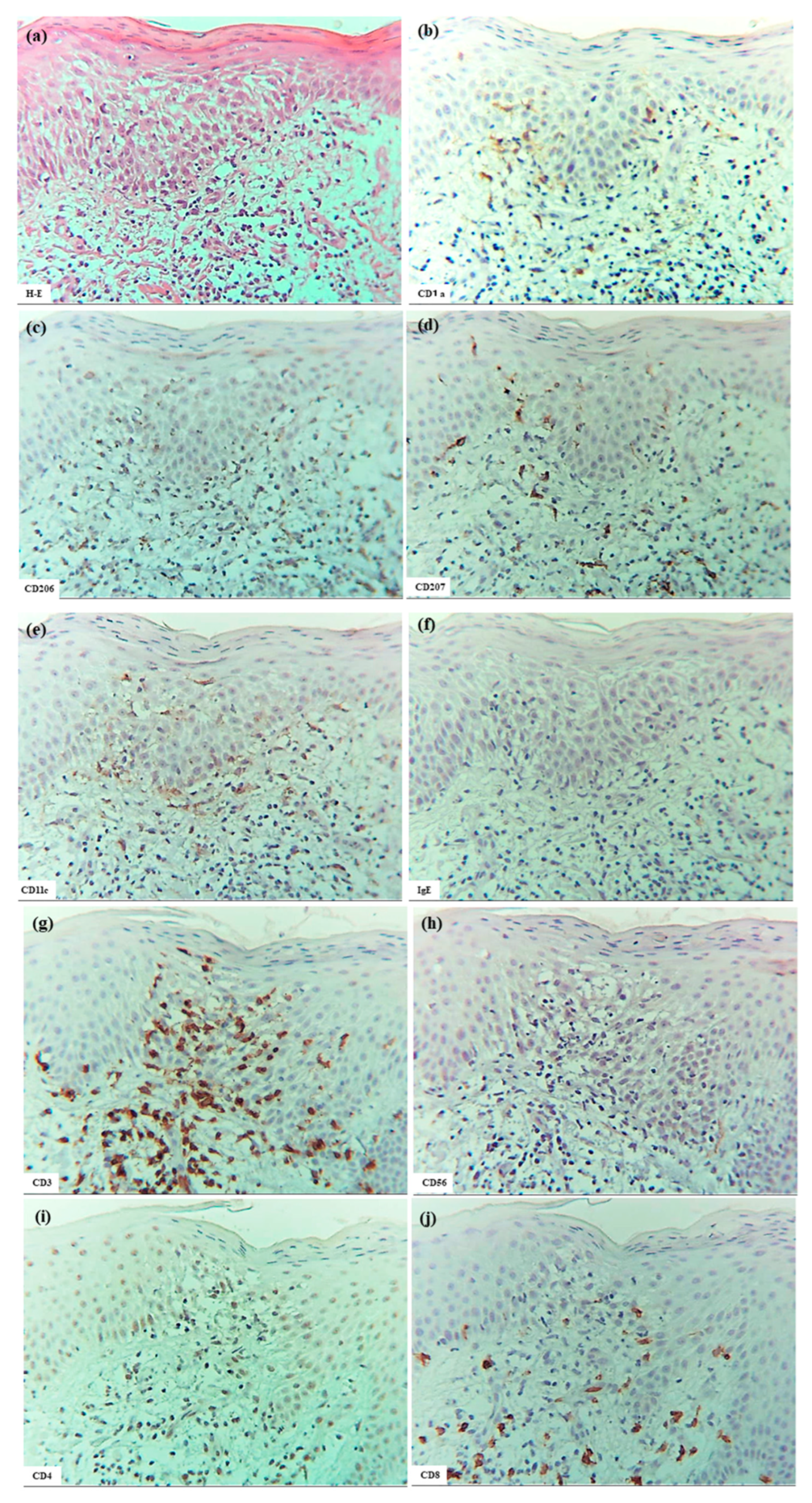 Dermatopathology 12 00023 g005