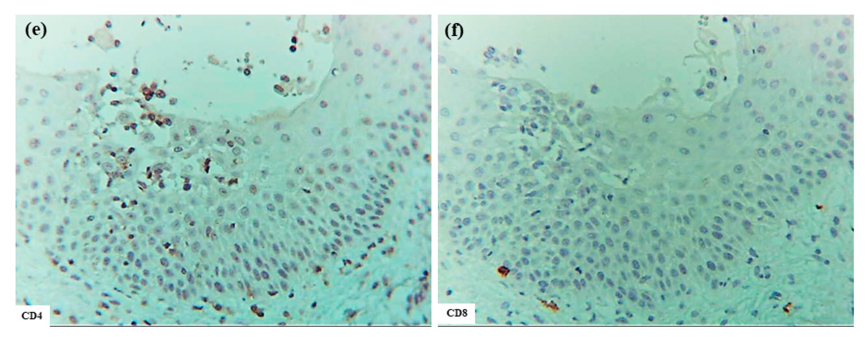 Dermatopathology 12 00023 g006b