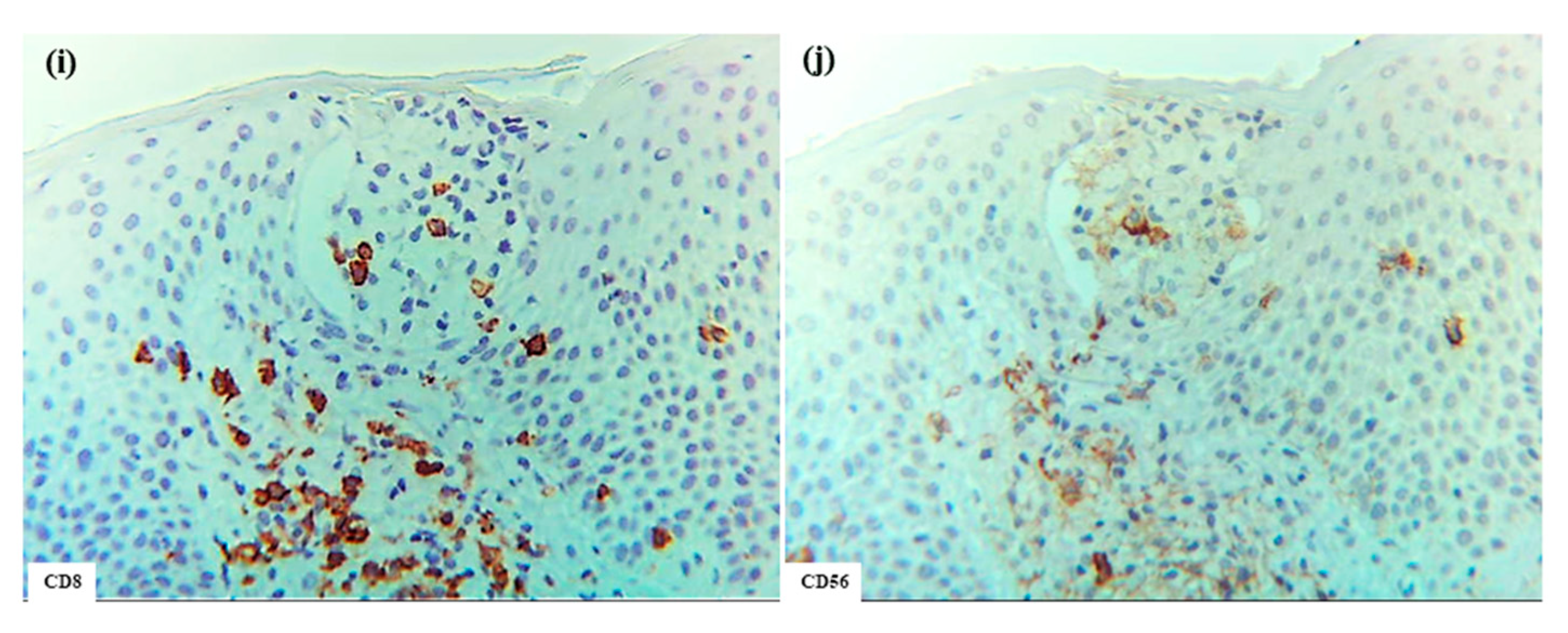 Dermatopathology 12 00023 g008b