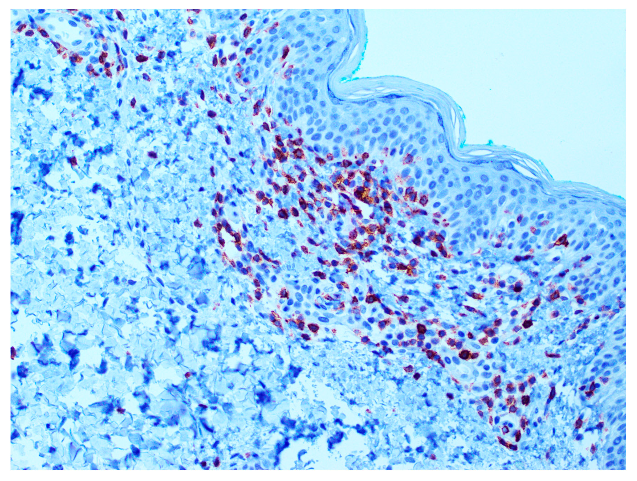 Dermatopathology 12 00029 g004