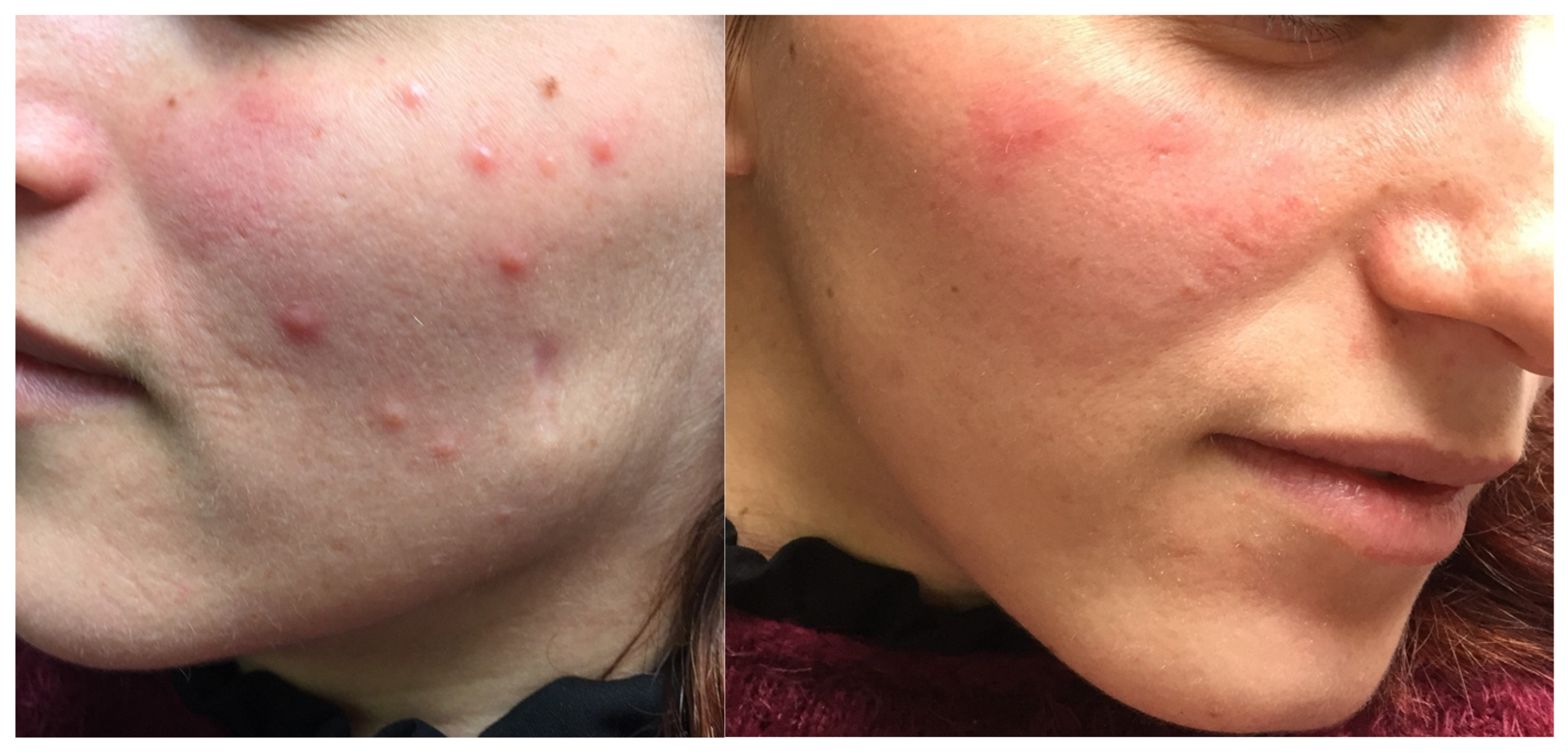 Dermatopathology 12 00032 g001