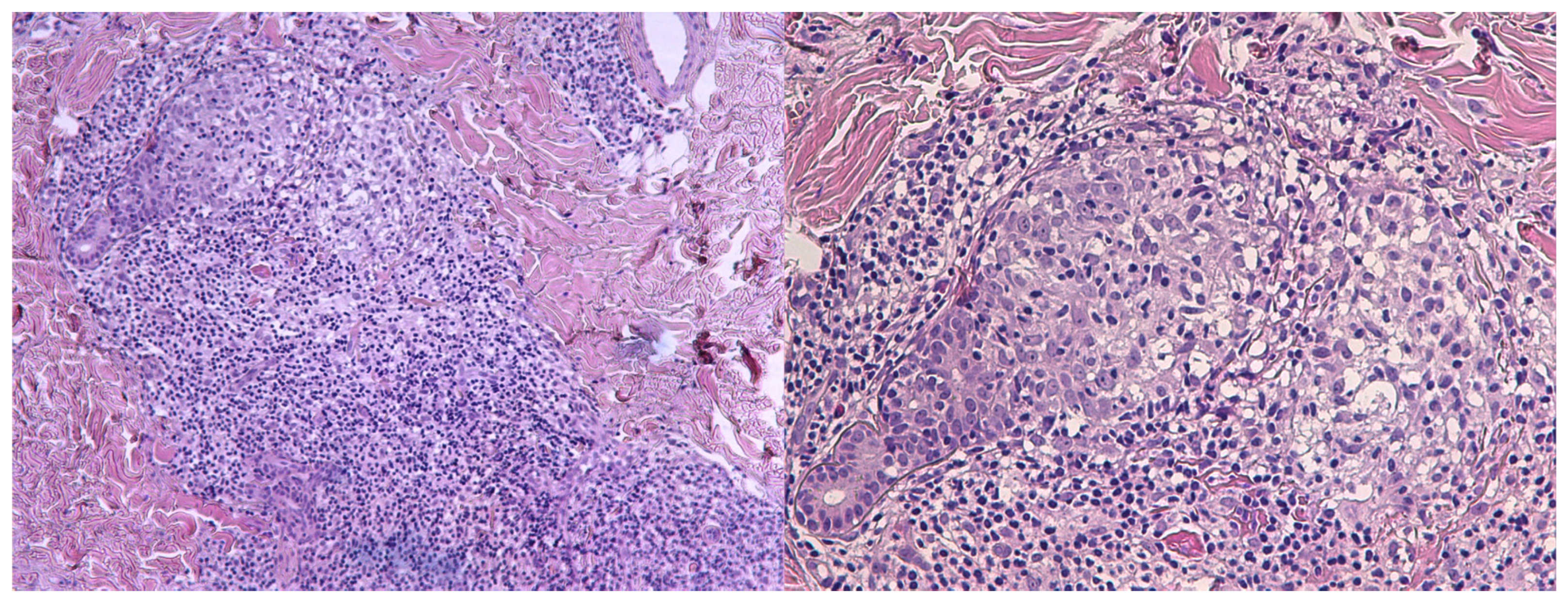 Dermatopathology 12 00032 g002