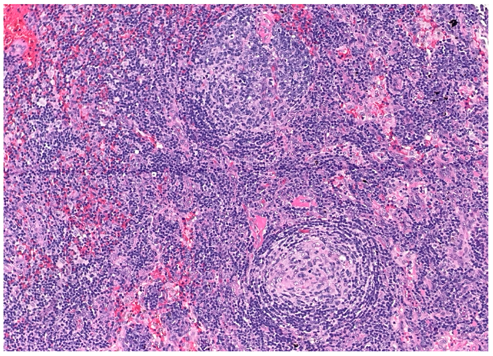 Dermatopathology 12 00033 g003 Dermatopathology 12 00033 g003