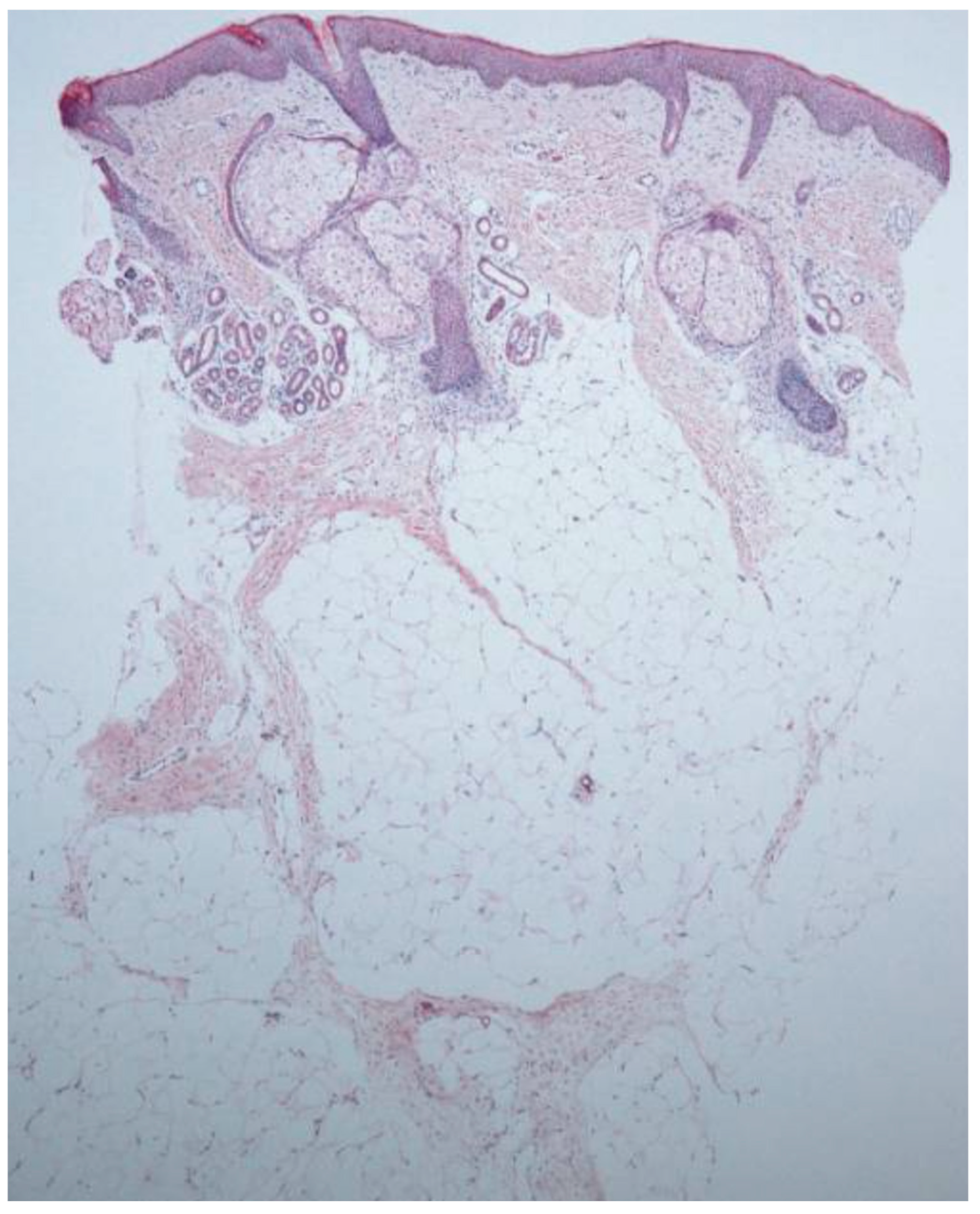 Dermatopathology 12 00039 g001