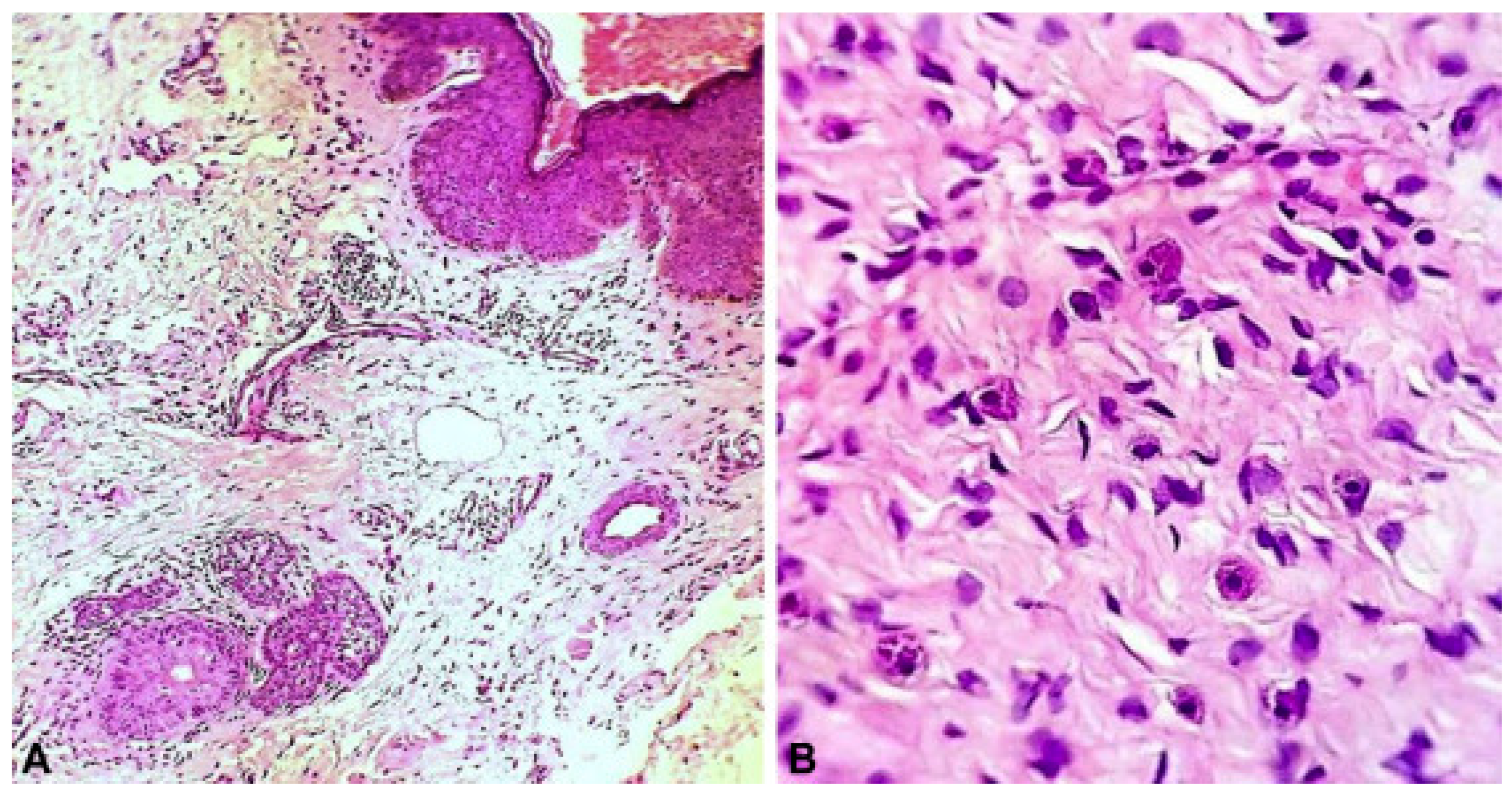 Dermatopathology 12 00039 g002