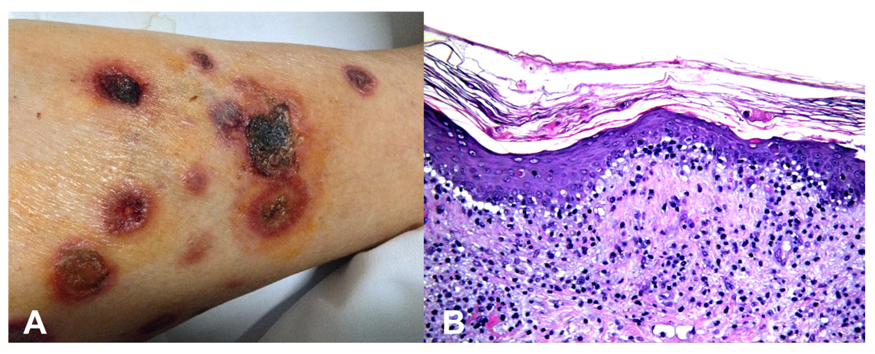 Dermatopathology 13 00003 g002 Dermatopathology 13 00003 g002