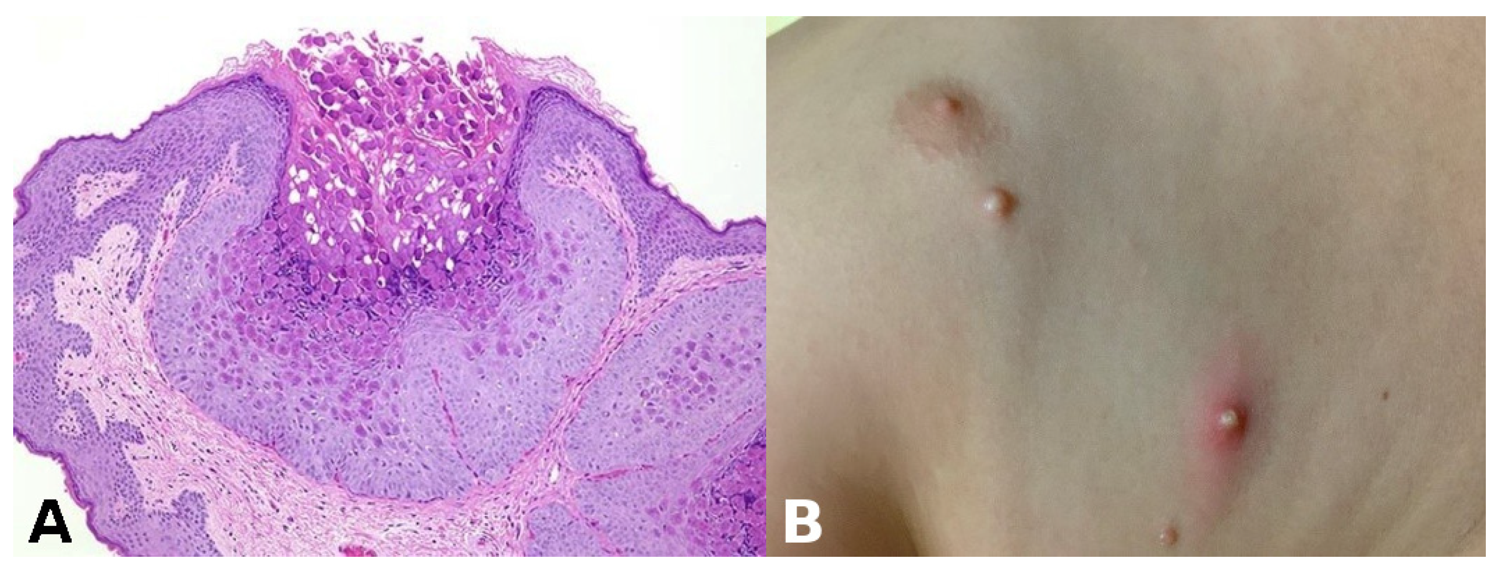 Dermatopathology 13 00003 g003 Dermatopathology 13 00003 g003