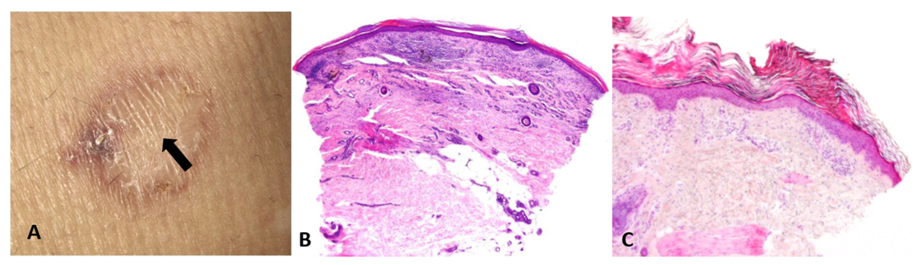 Dermatopathology 13 00003 g005 Dermatopathology 13 00003 g005
