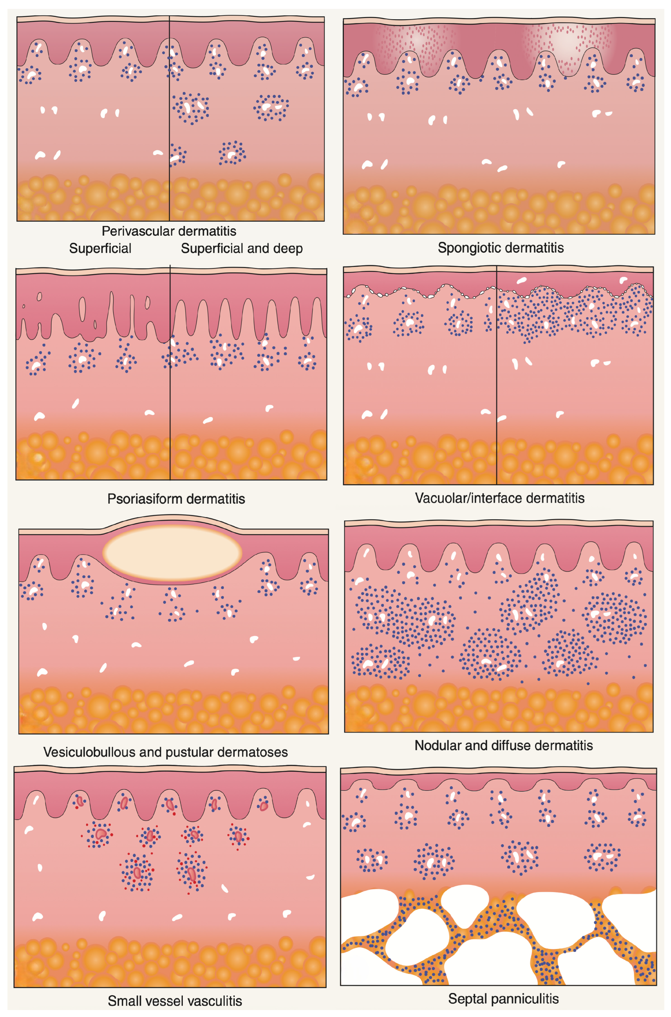 Dermatopathology 13 00003 g007 Dermatopathology 13 00003 g007