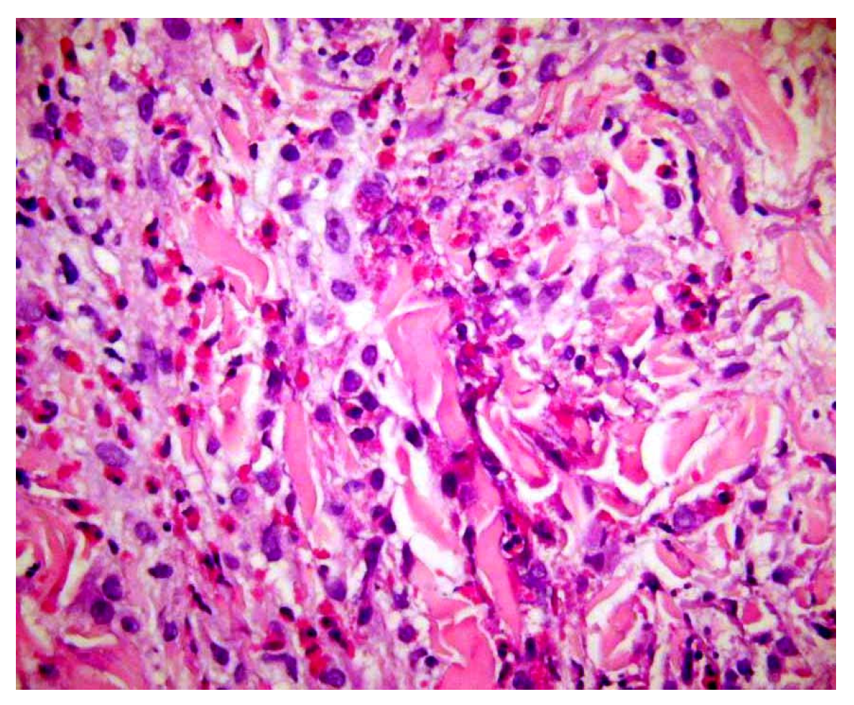 Dermatopathology 13 00003 g008 Dermatopathology 13 00003 g008