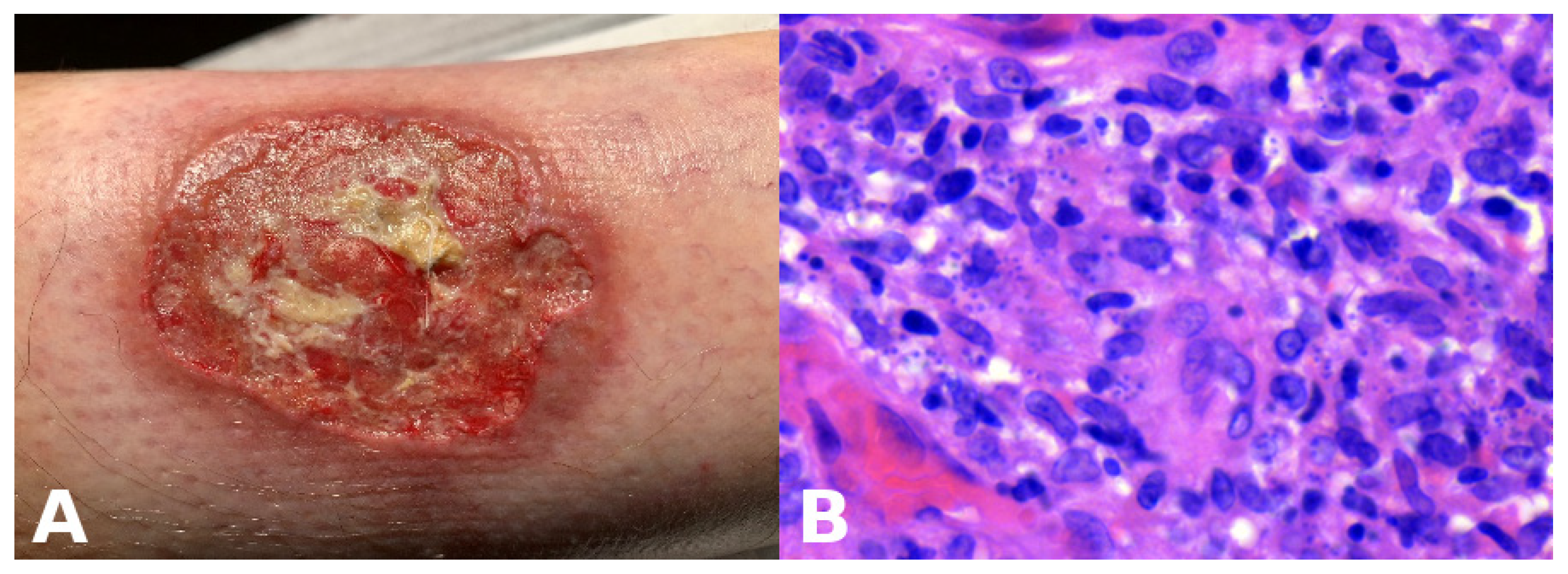 Dermatopathology 13 00003 g009 Dermatopathology 13 00003 g009