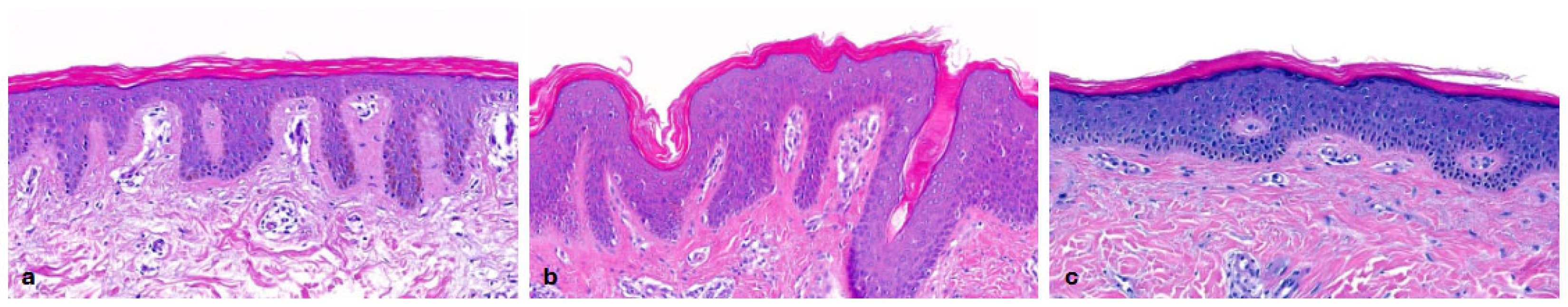 Dermatopathology 13 00009 g002 Dermatopathology 13 00009 g002