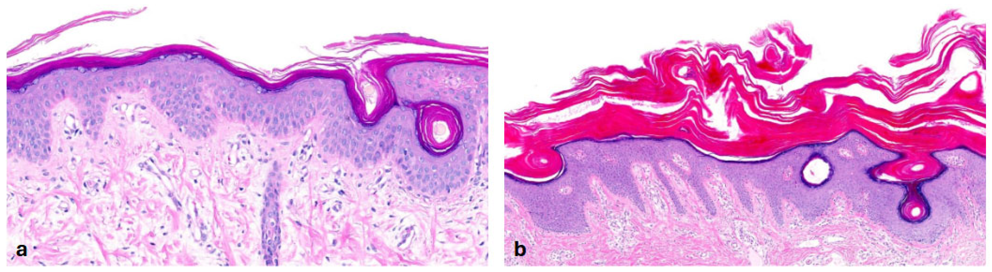 Dermatopathology 13 00009 g003 Dermatopathology 13 00009 g003