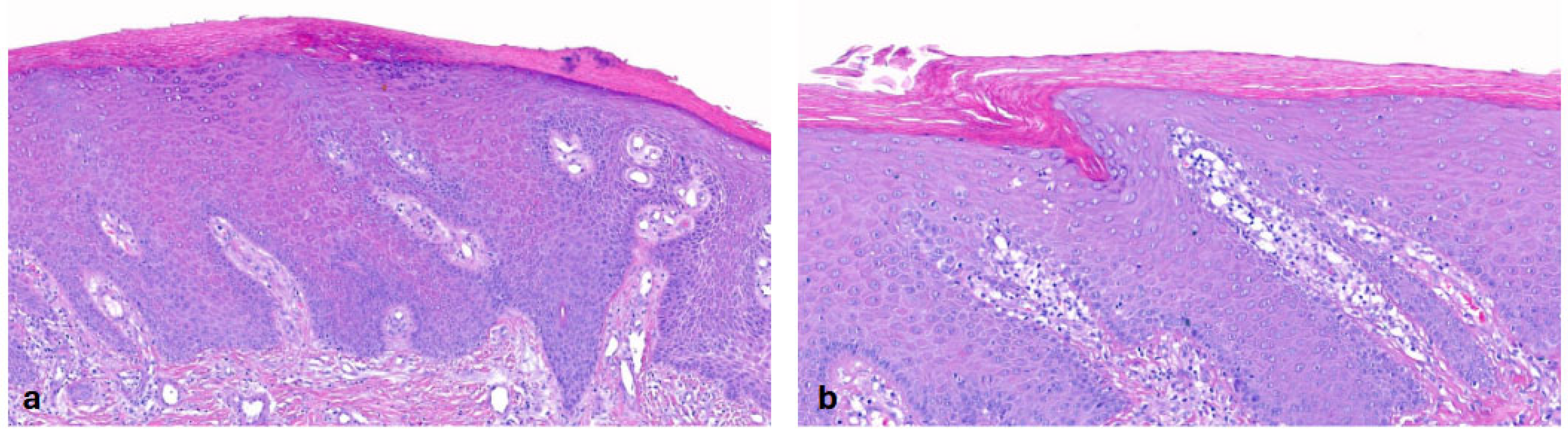 Dermatopathology 13 00009 g004 Dermatopathology 13 00009 g004