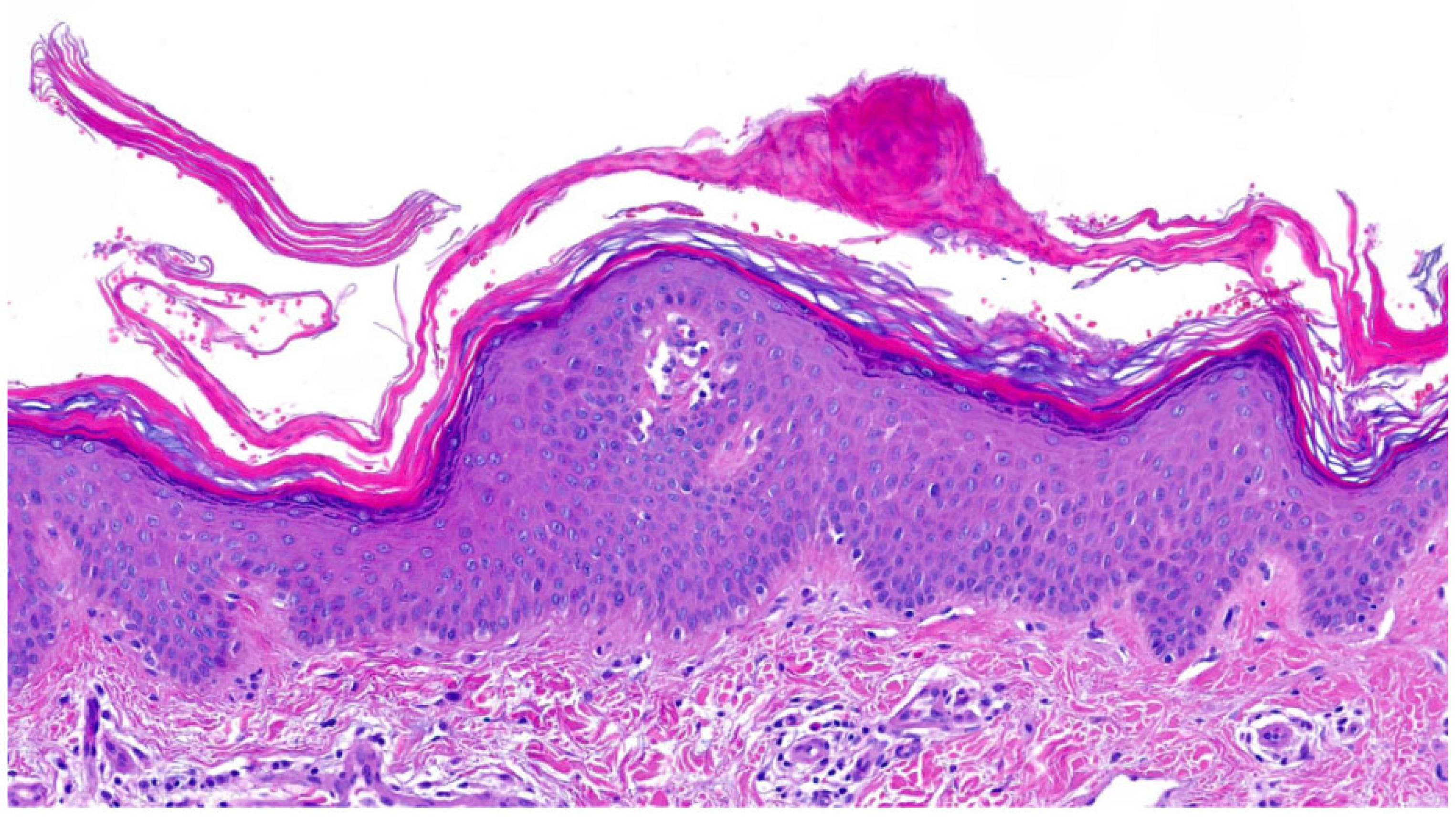 Dermatopathology 13 00009 g005 Dermatopathology 13 00009 g005