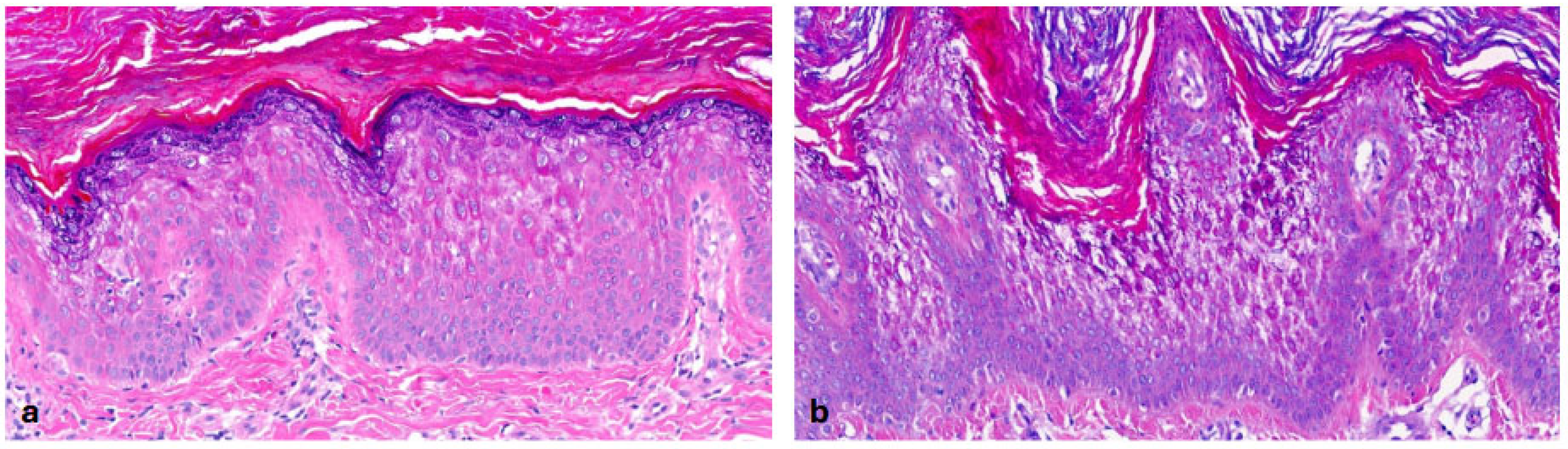 Dermatopathology 13 00009 g006 Dermatopathology 13 00009 g006