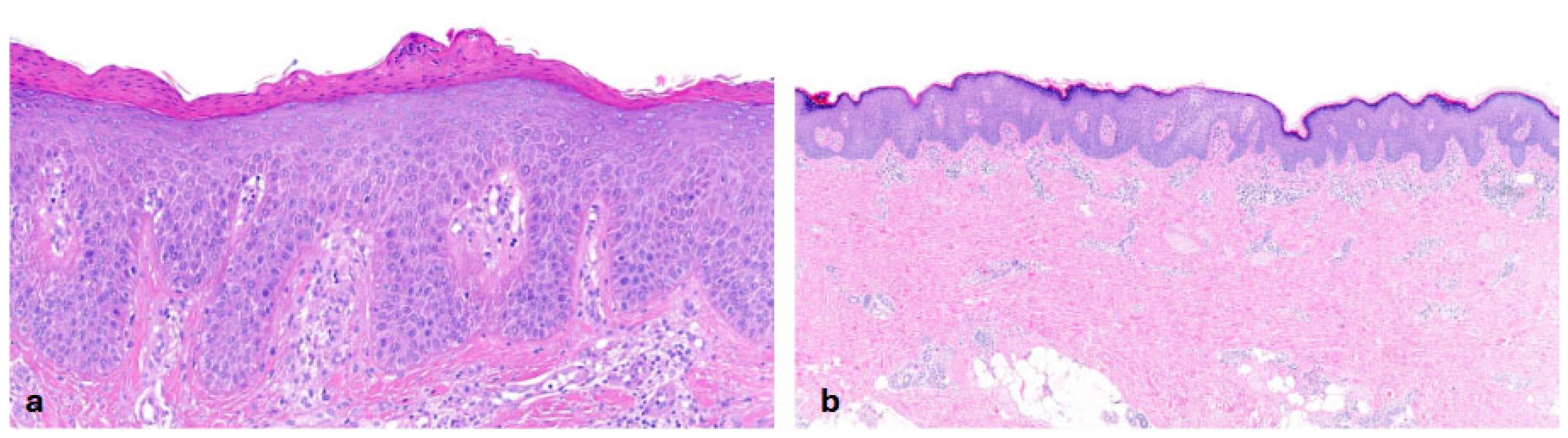 Dermatopathology 13 00009 g007 Dermatopathology 13 00009 g007
