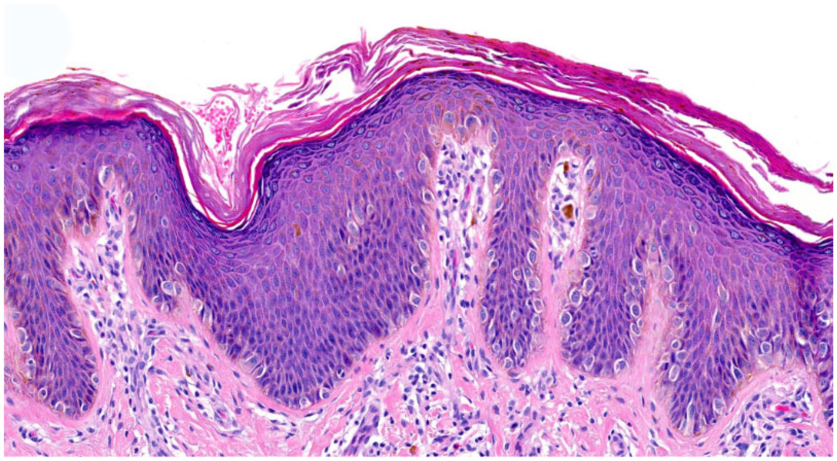 Dermatopathology 13 00009 g008 Dermatopathology 13 00009 g008