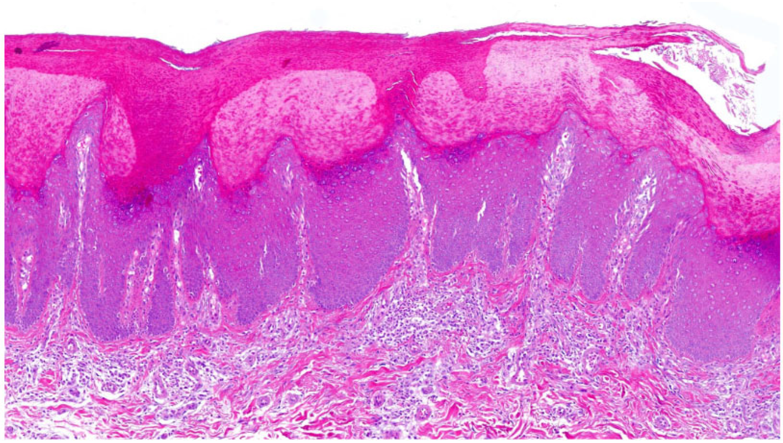 Dermatopathology 13 00009 g009 Dermatopathology 13 00009 g009