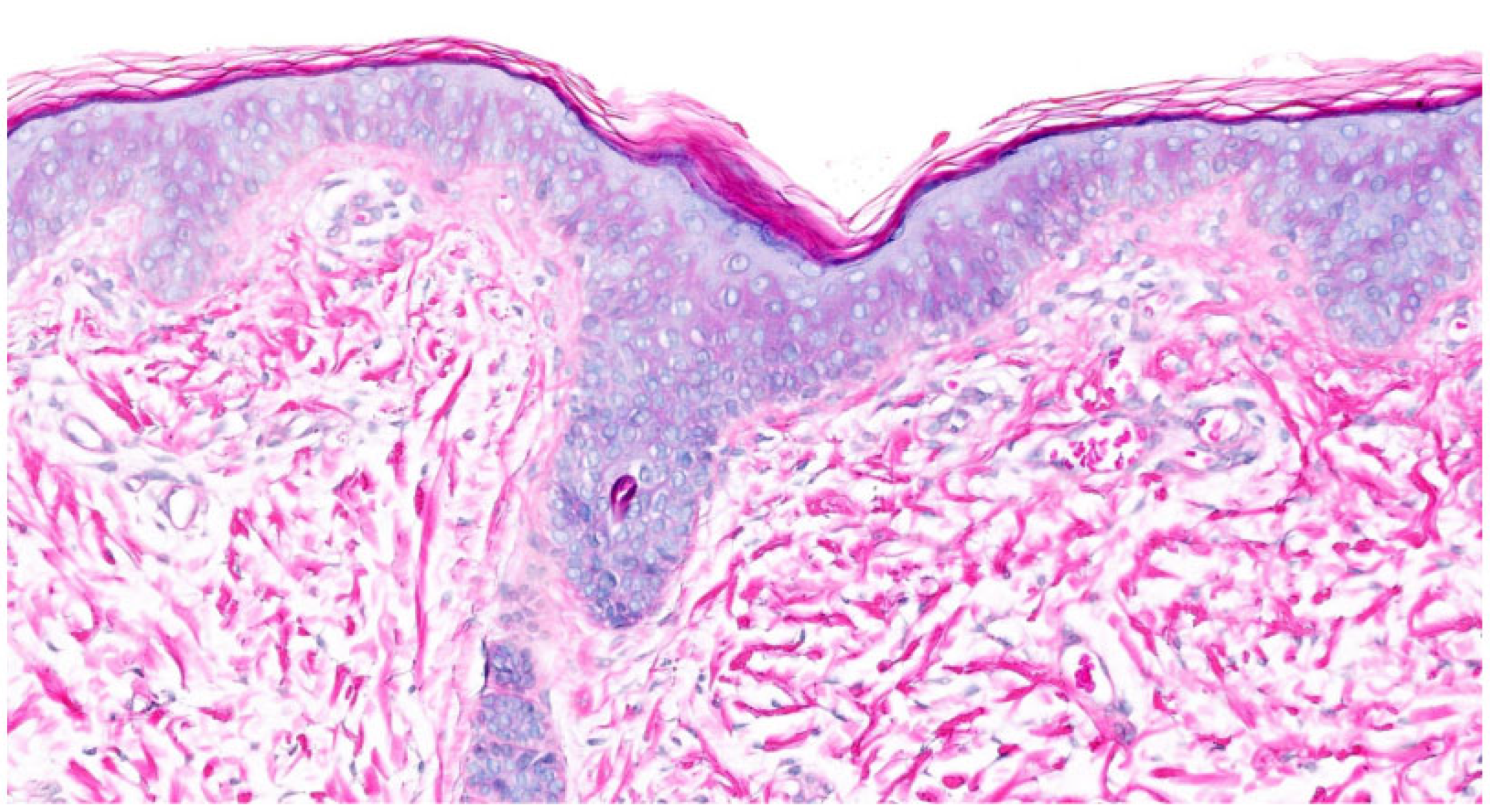 Dermatopathology 13 00009 g010 Dermatopathology 13 00009 g010